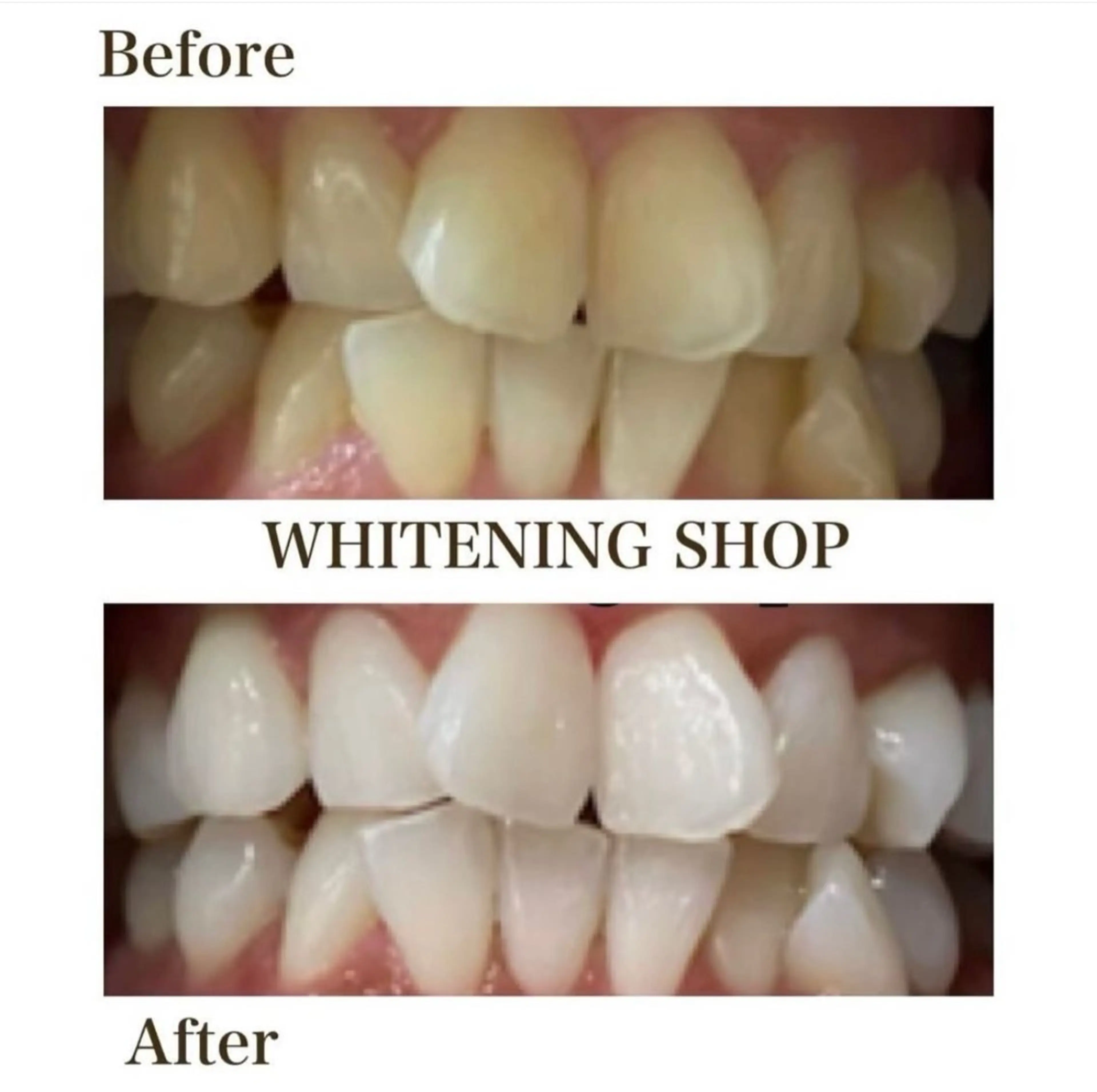 ホワイトニング ショップ伊丹店のその他イメージ