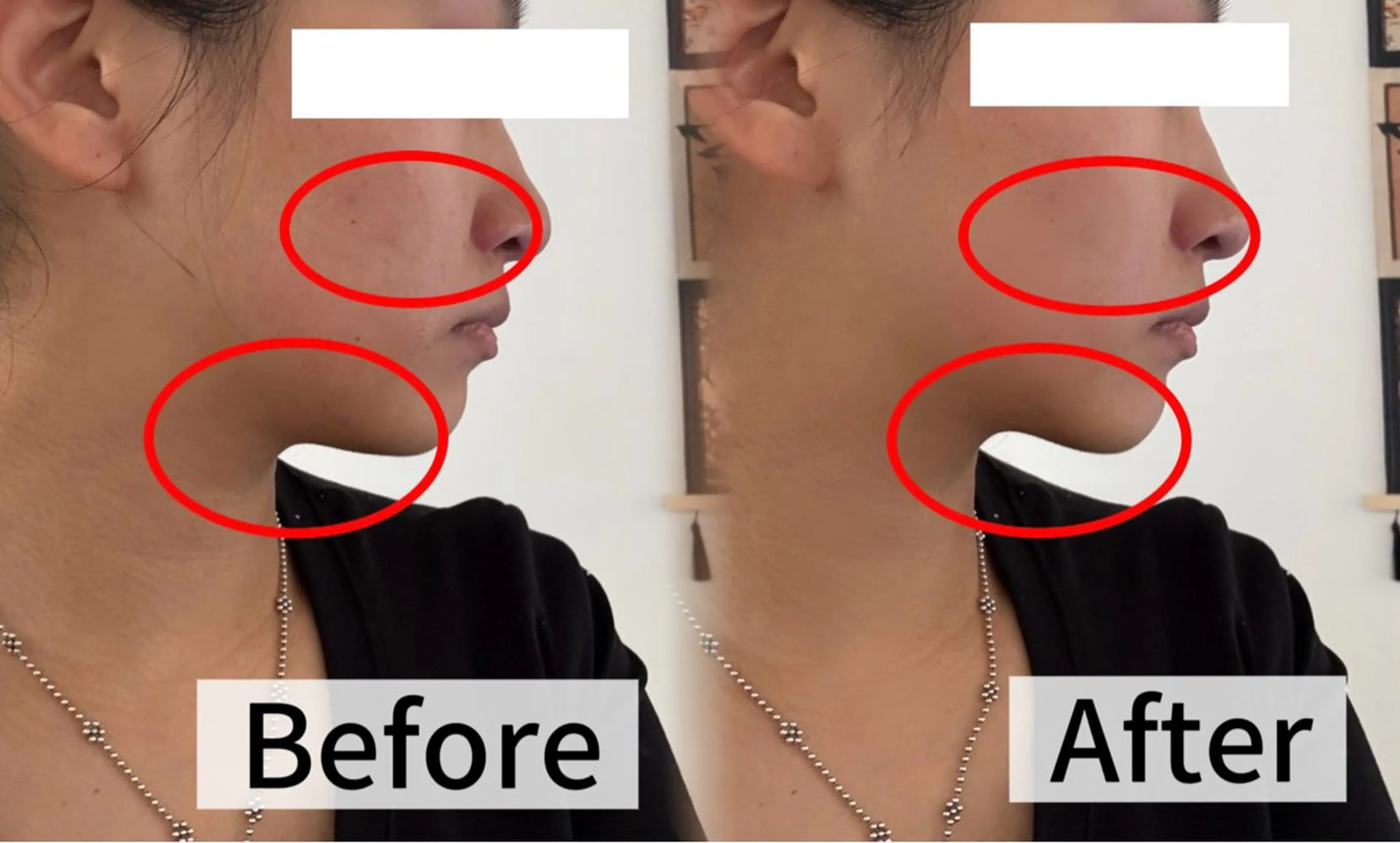 LUMINA ESTHのエステ・リラクイメージ