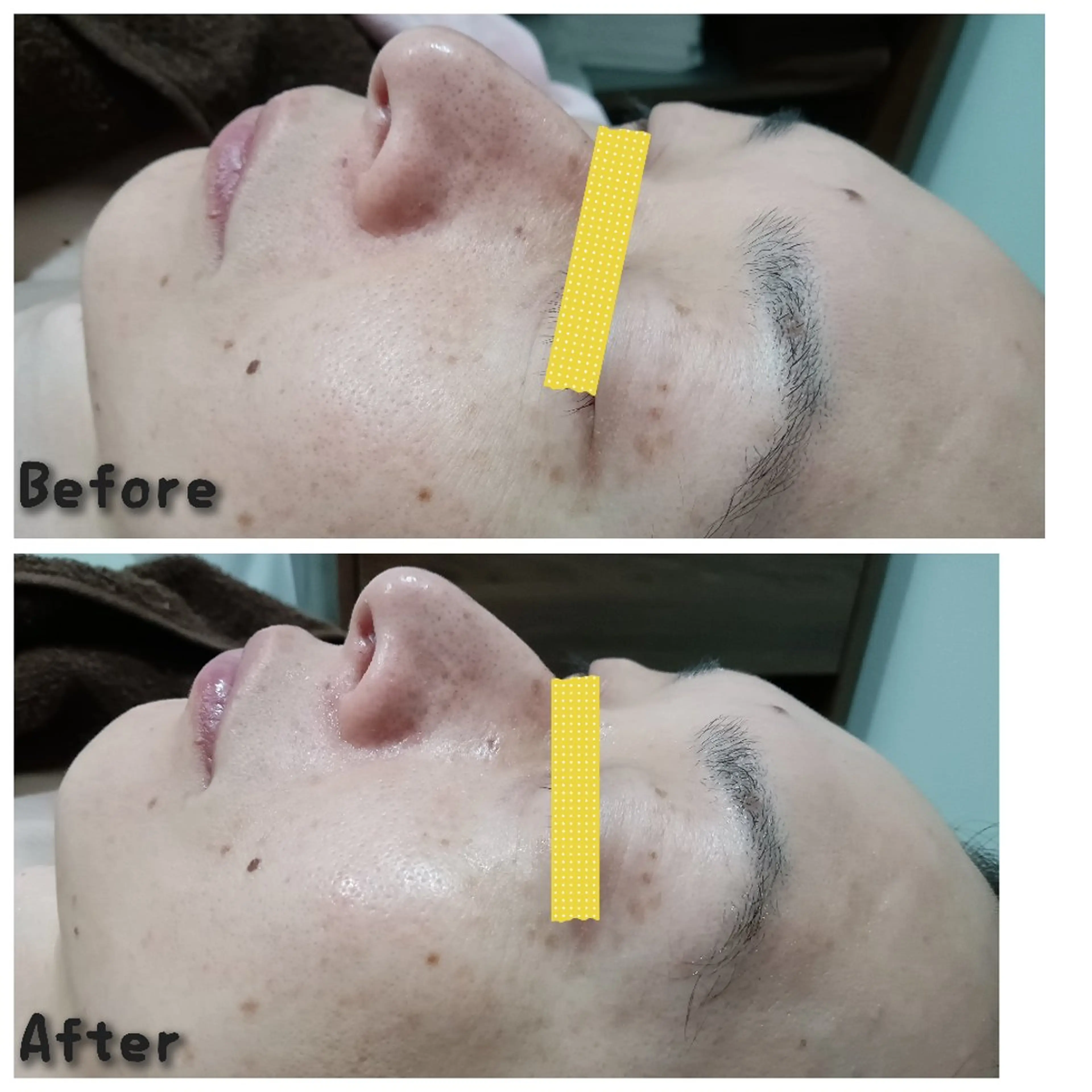 エステティクサロン Moon-bellのエステ・リラクイメージ