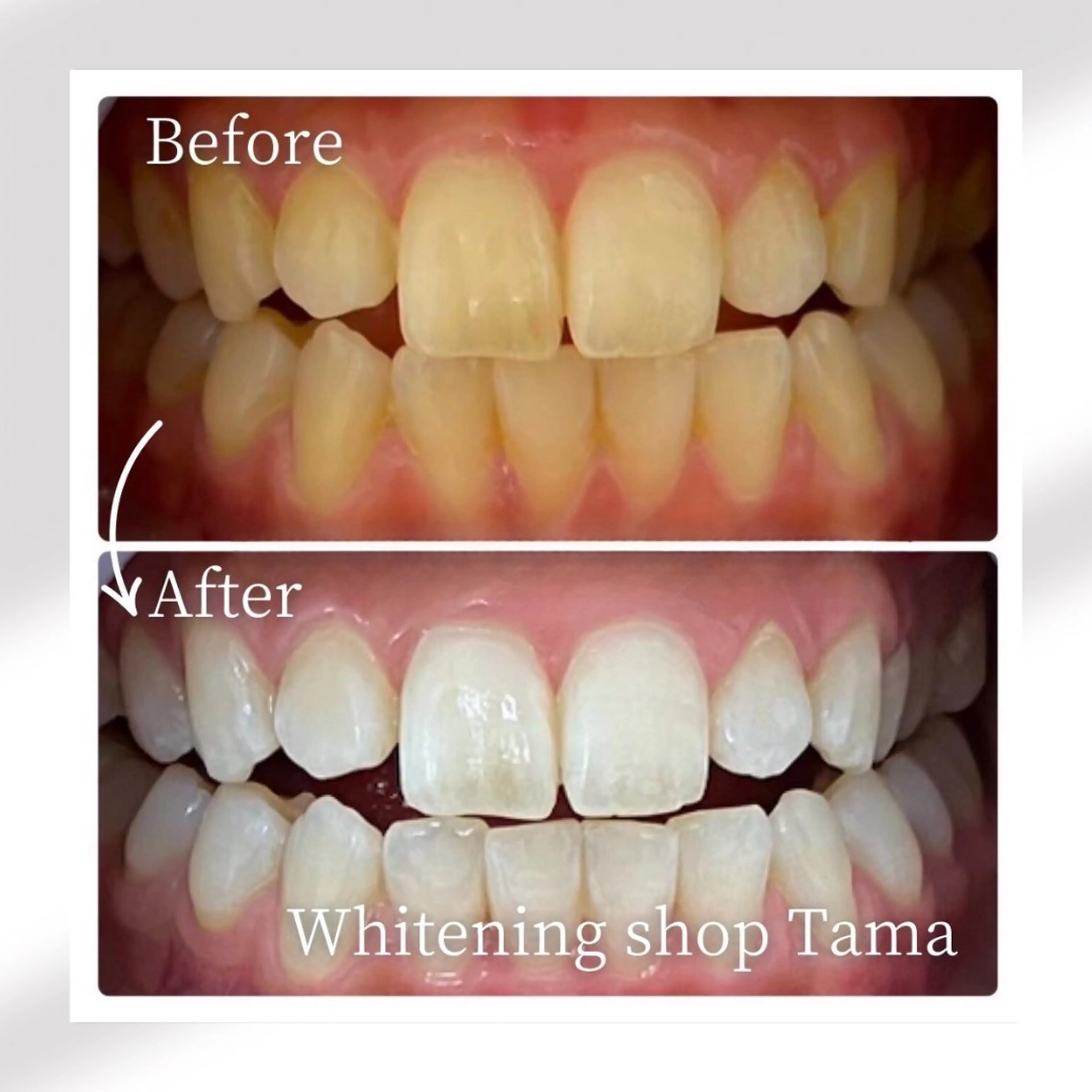 メンズ ホワイトニング ショップ多摩店のその他イメージ