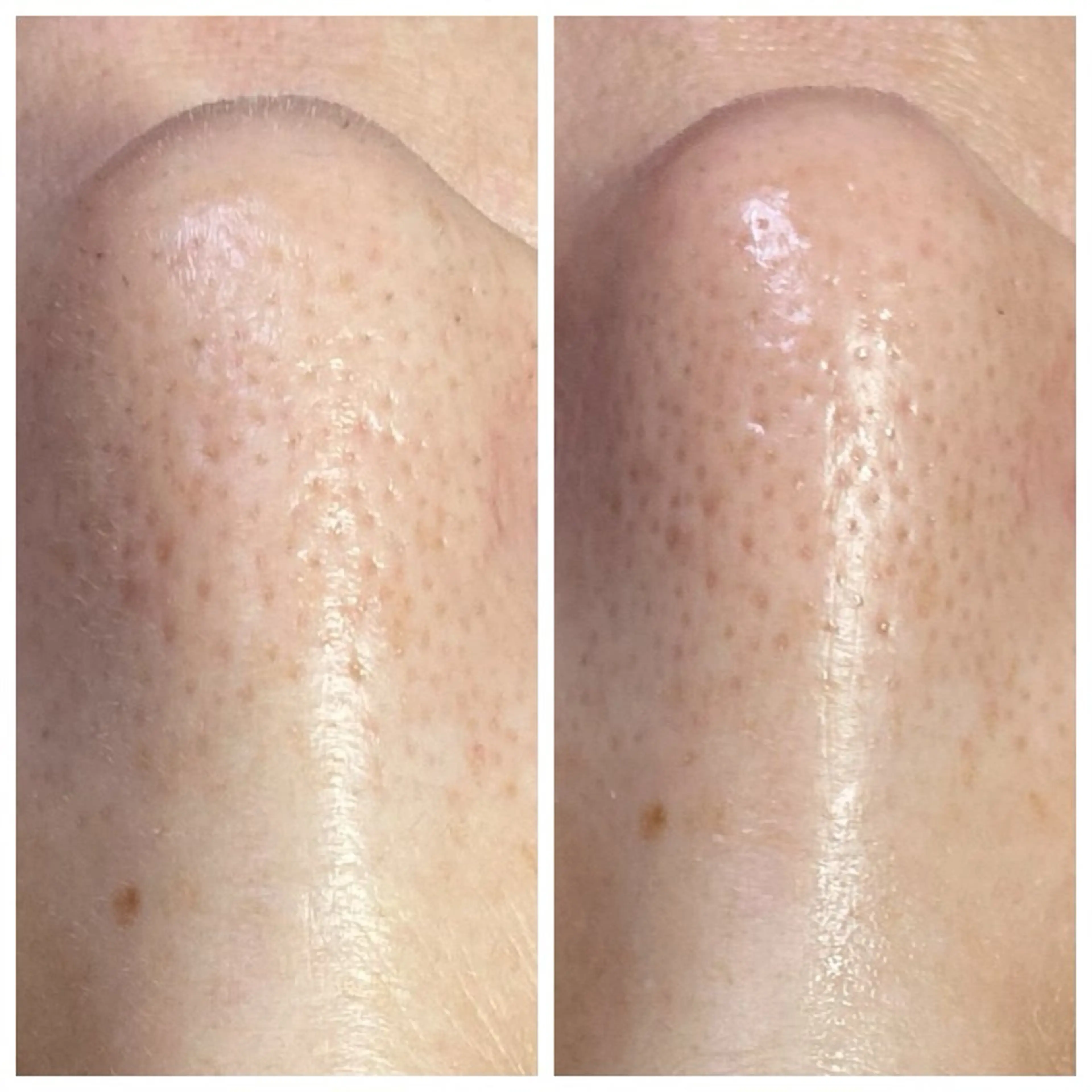 脱毛 産毛専門店 Bittoのエステ・リラクイメージ