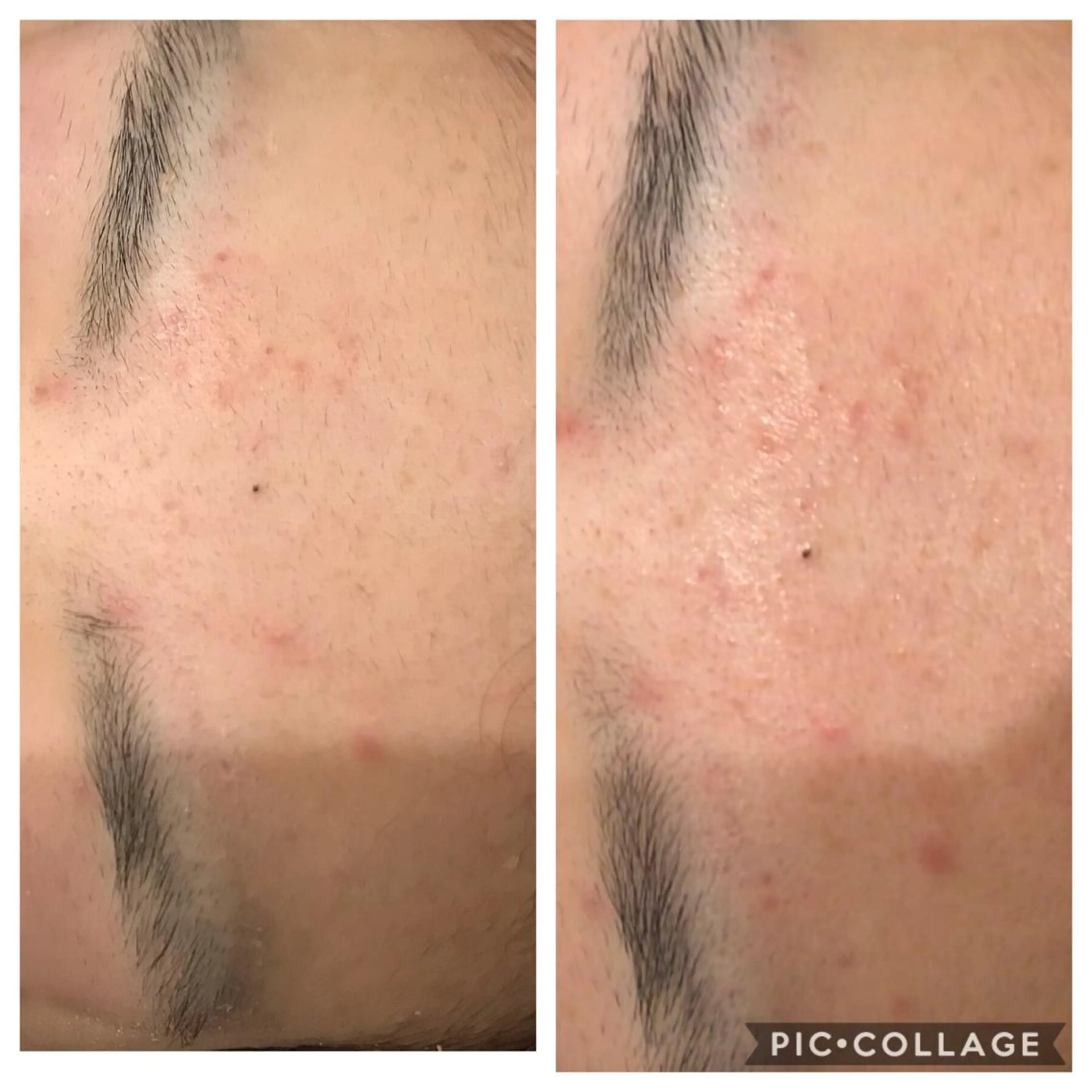 セミロング カラー パーマ ヘアアレンジ メンズ キッズ ネイル マツエク・マツパ 金の糸脱毛 産毛ケア専門のエステ・リラクイメージ