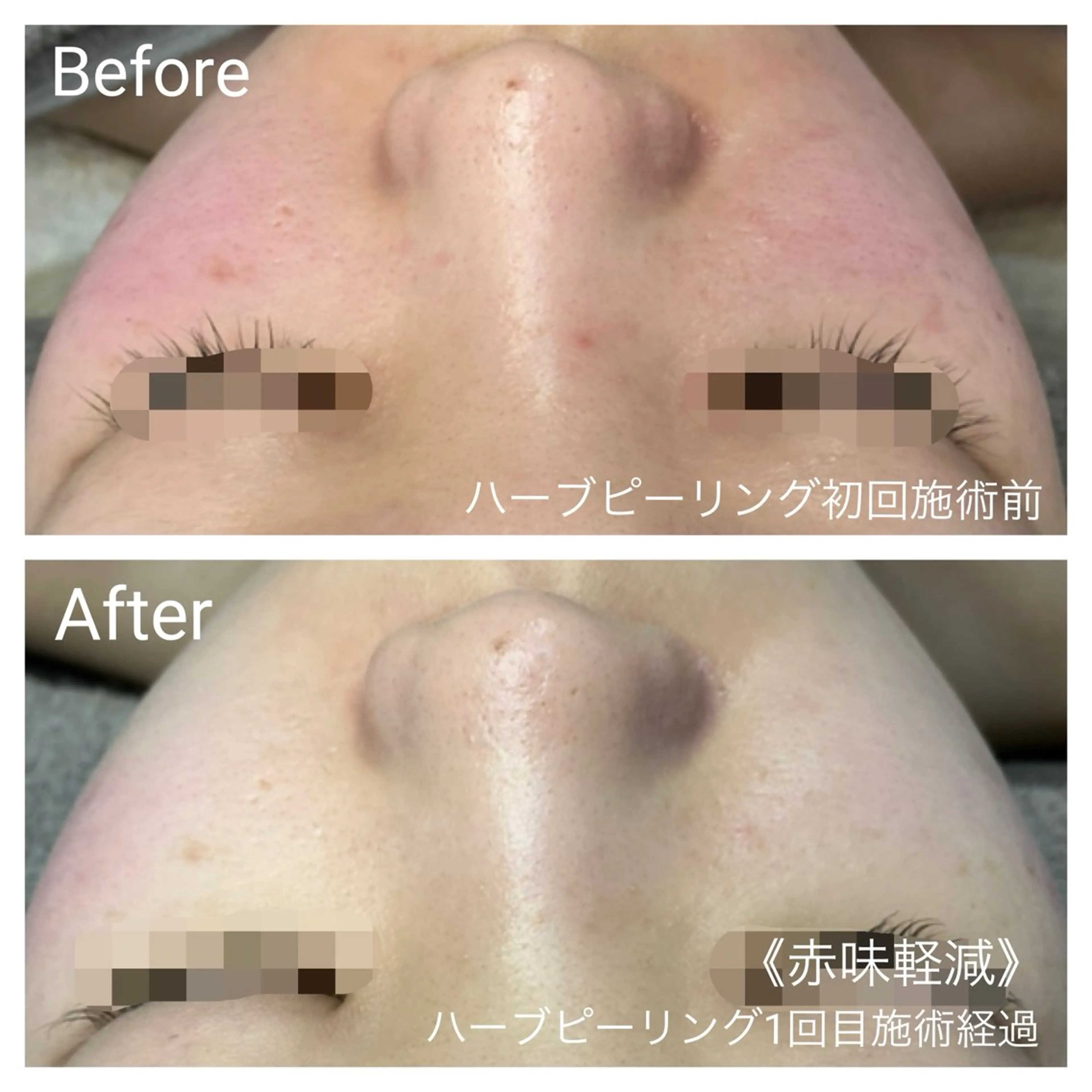 エステ リラク 深い肌悩み&早期脱毛 完了サロンのエステ・リラクイメージ