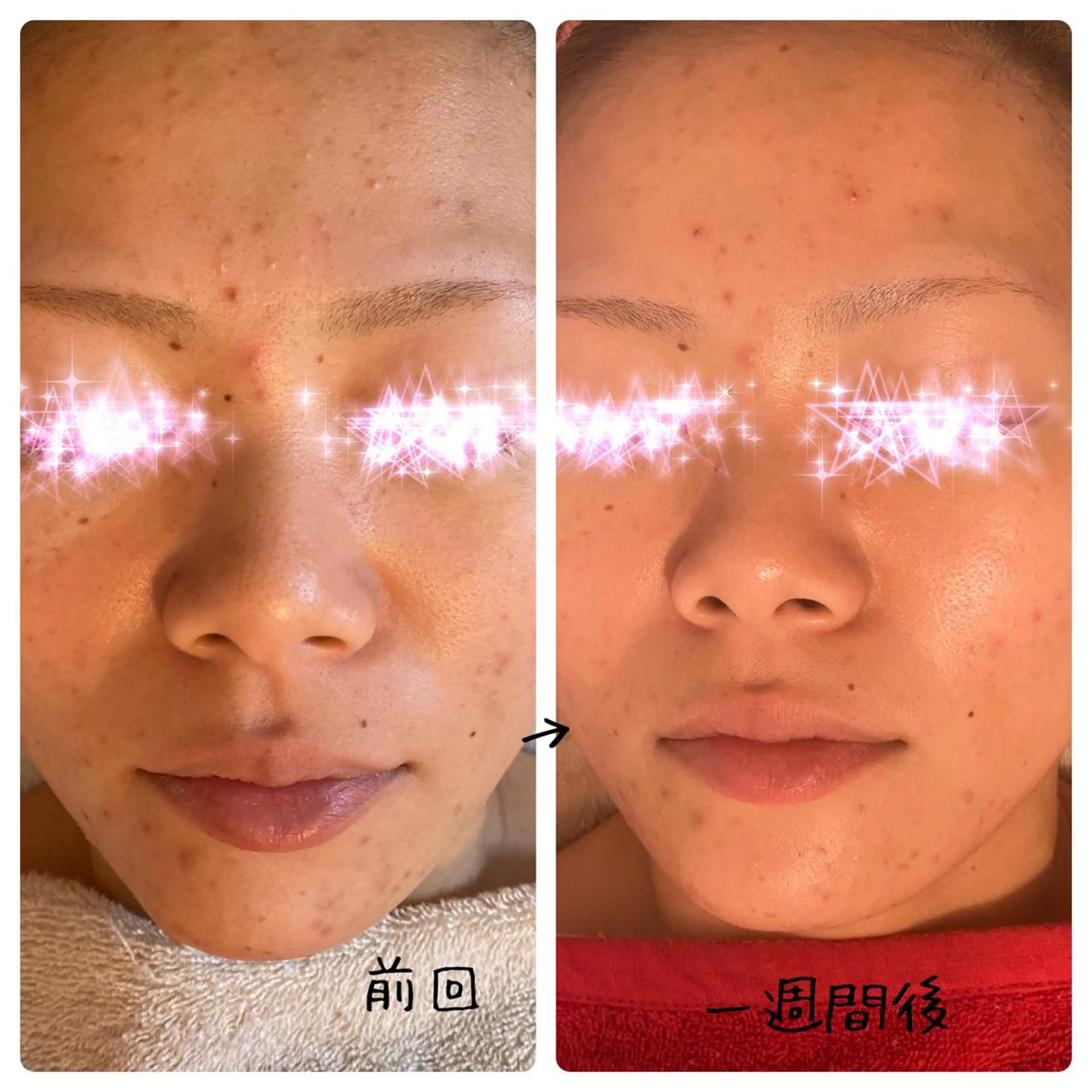 fairyrose organicエステのエステ・リラクイメージ