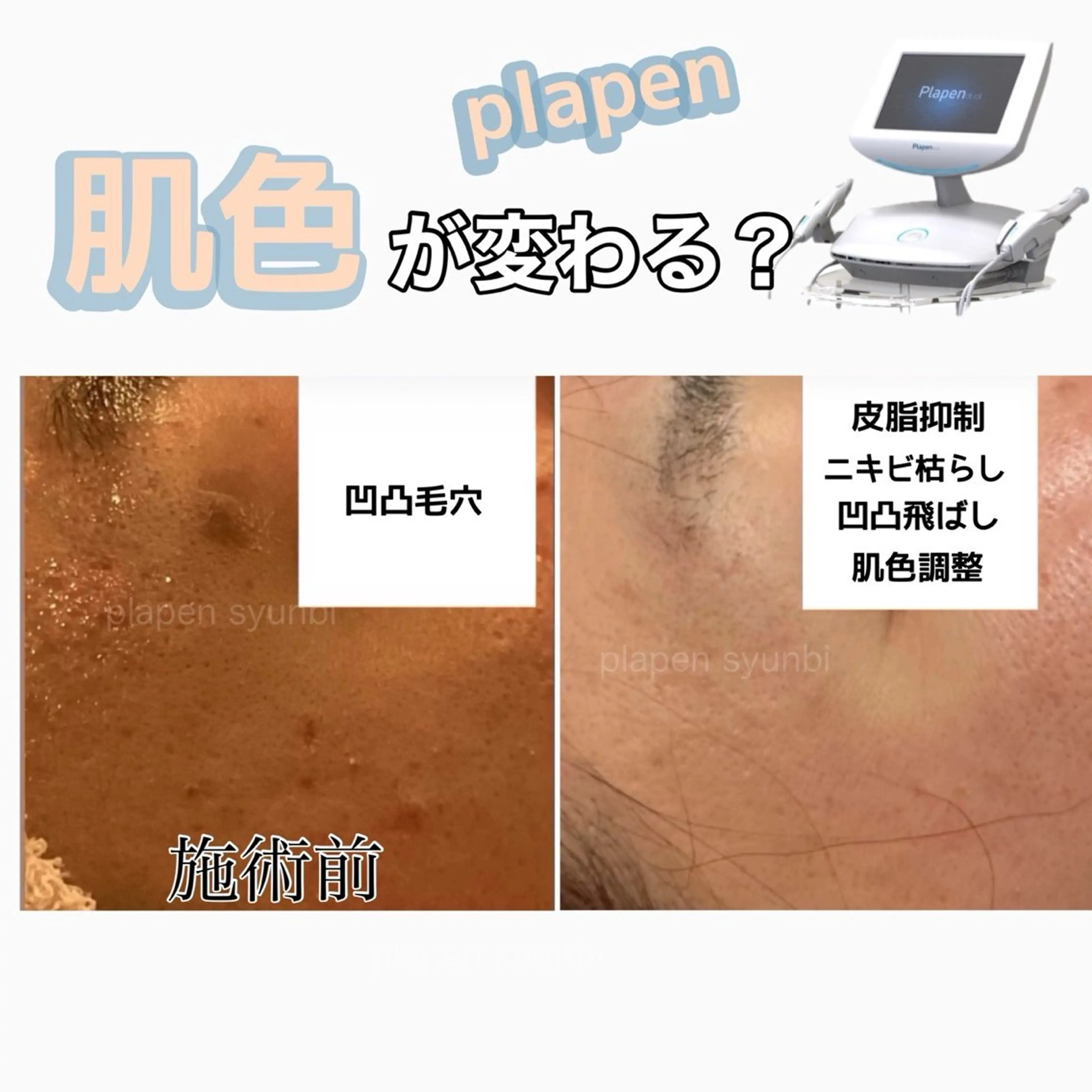 エステ Lumiere despoirのエステ・リラクイメージ