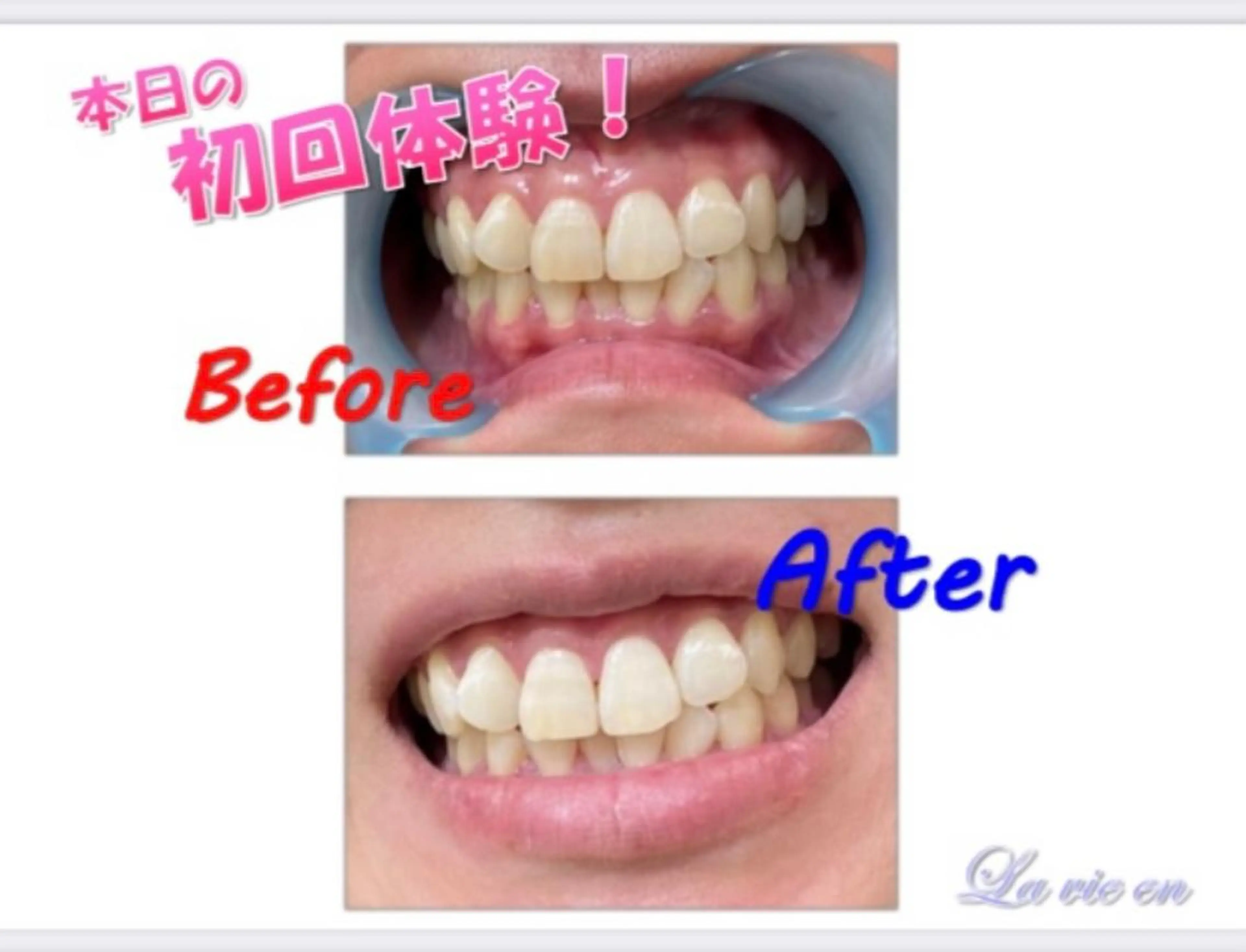 その他 ホワイトニングサロン La vie enのその他イメージ