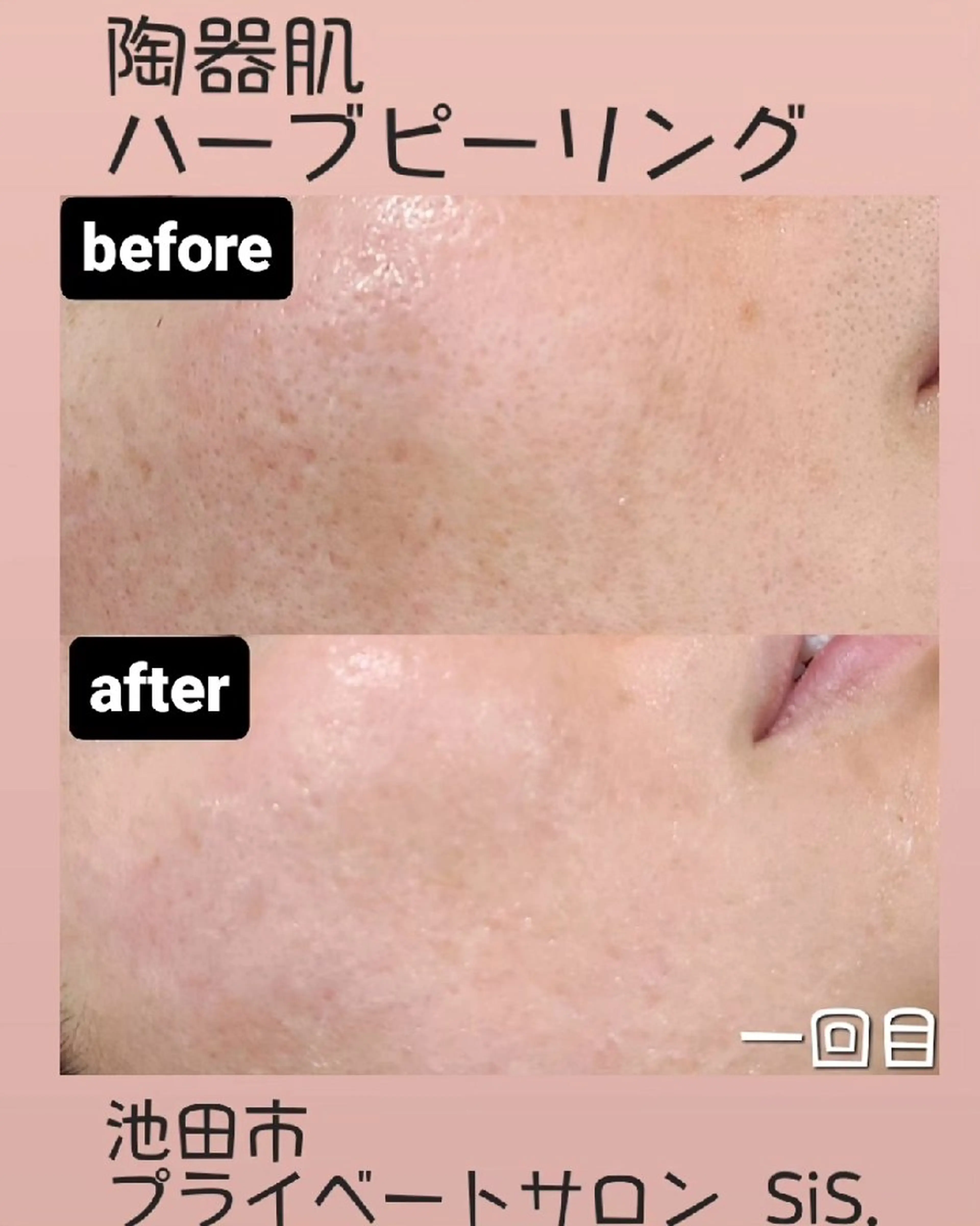 BEAUTYSARON　SiS.所属・高橋 沙奈江のエステ・リラクイメージ