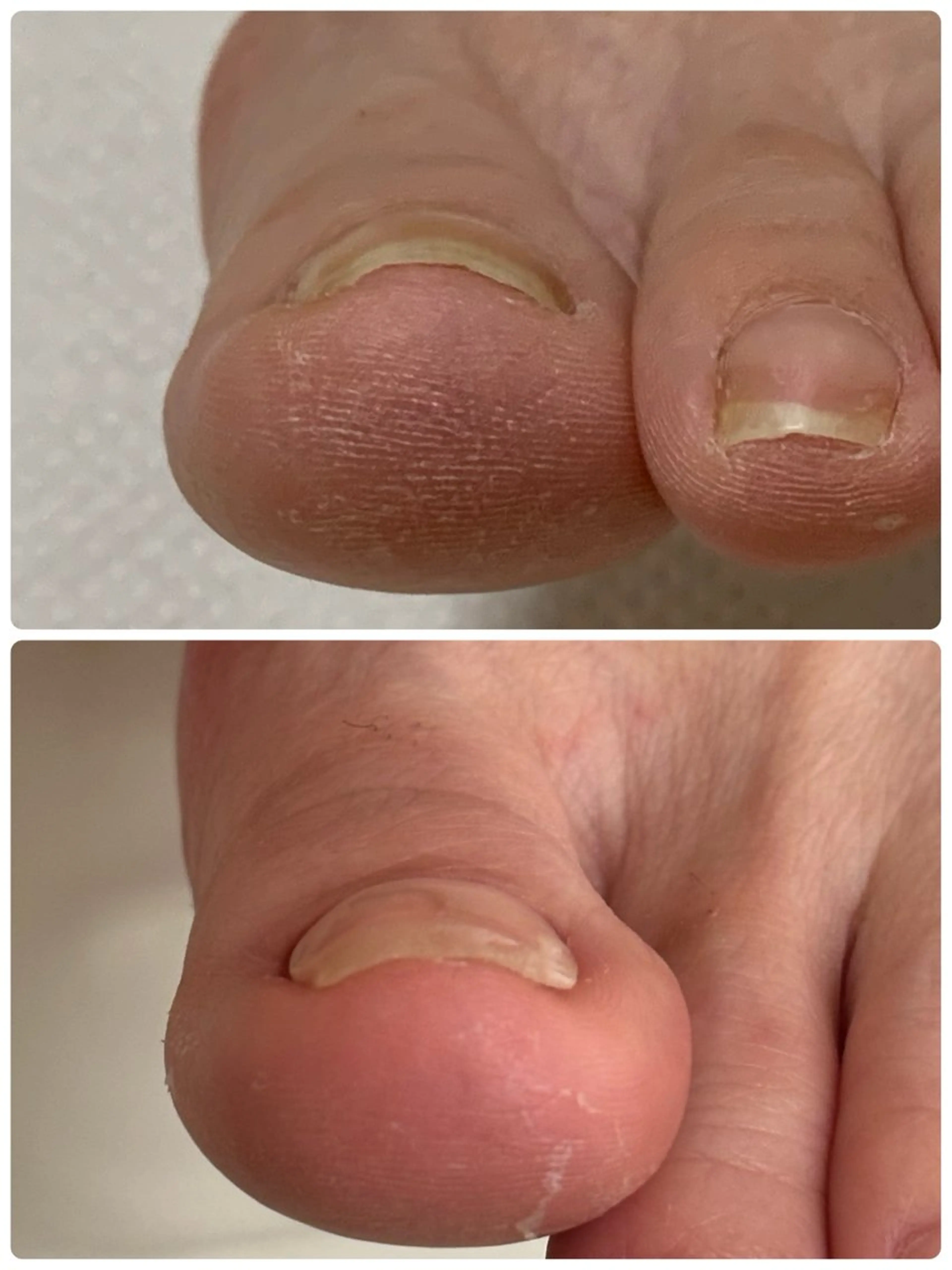 ネイル Alo.nail アロ•ネイルのネイルデザイン