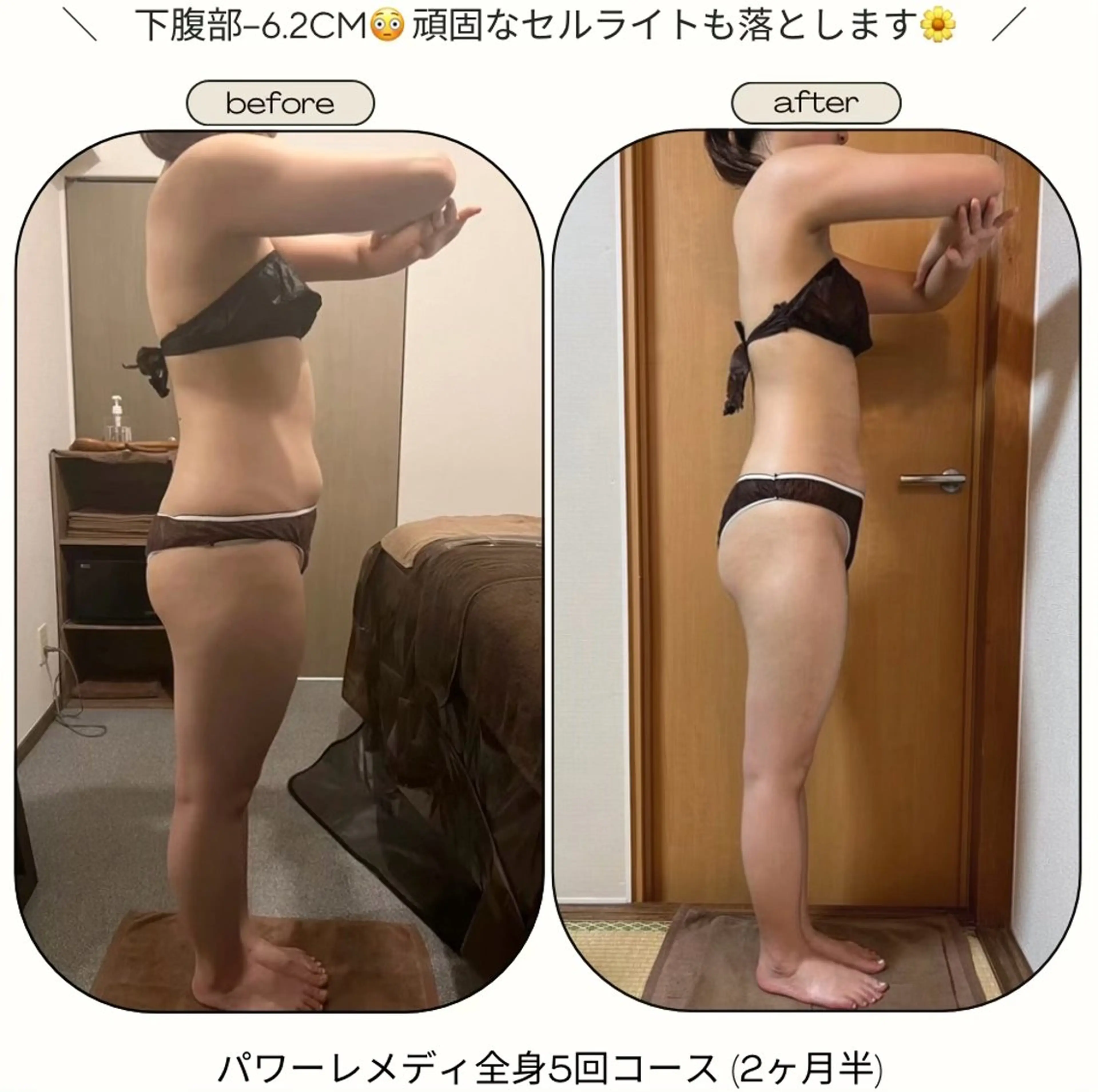 biloop所属・《本気痩せ×疲労改善 》  BILOOPのエステ・リラクイメージ