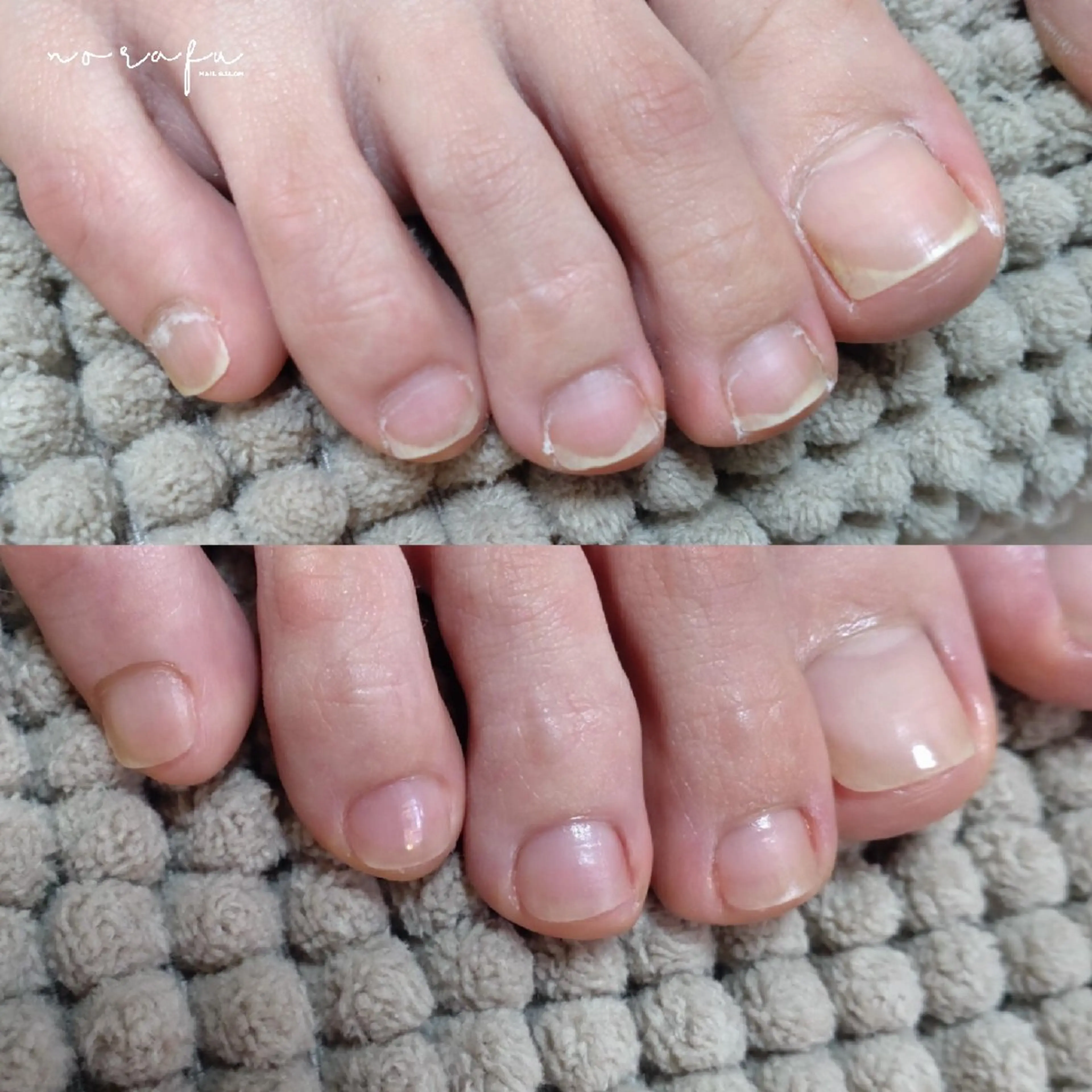 ネイル フットネイル nail 　norafu.のネイルデザイン