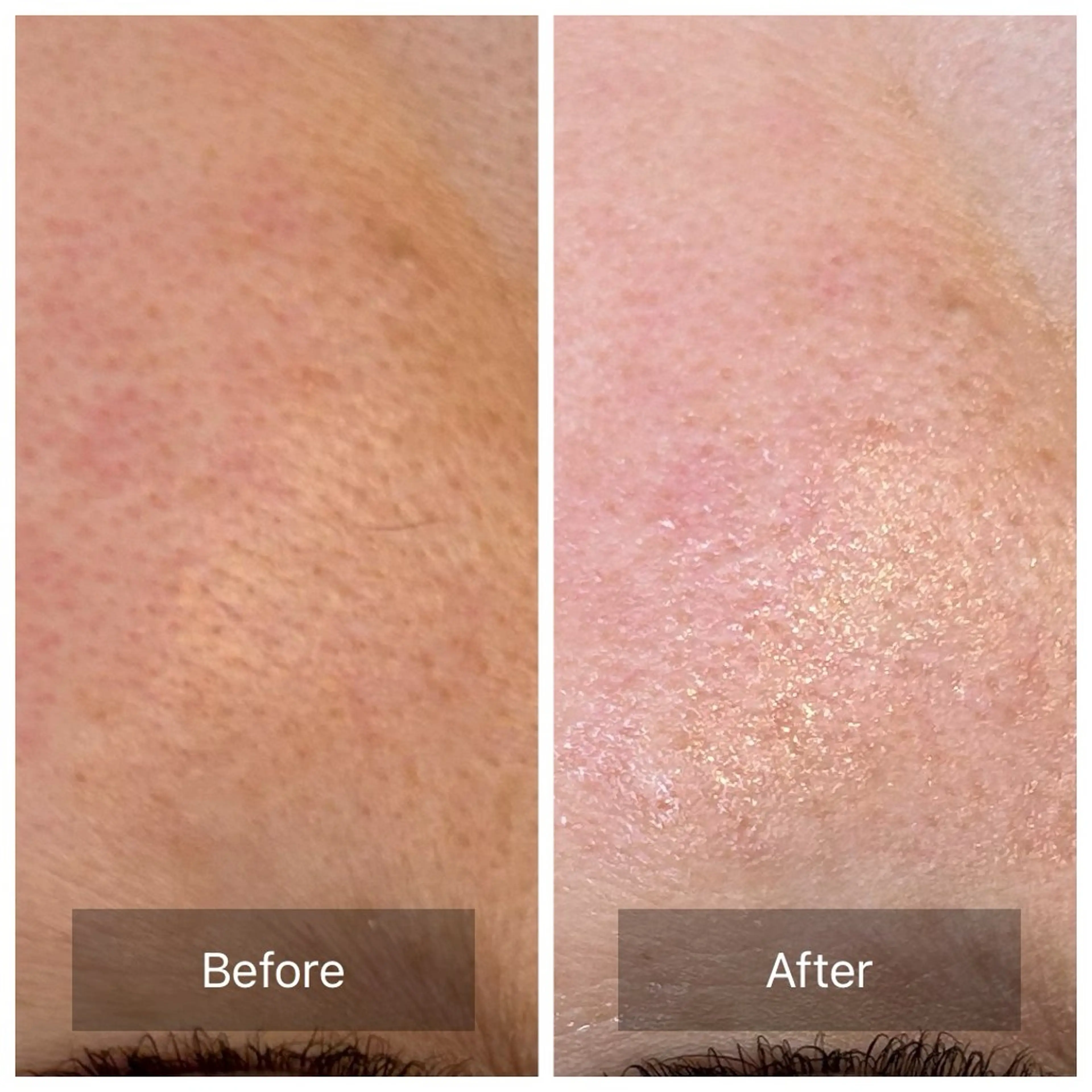 ほてり・敏感ケア🍁【通常8,900円】約90分の写真