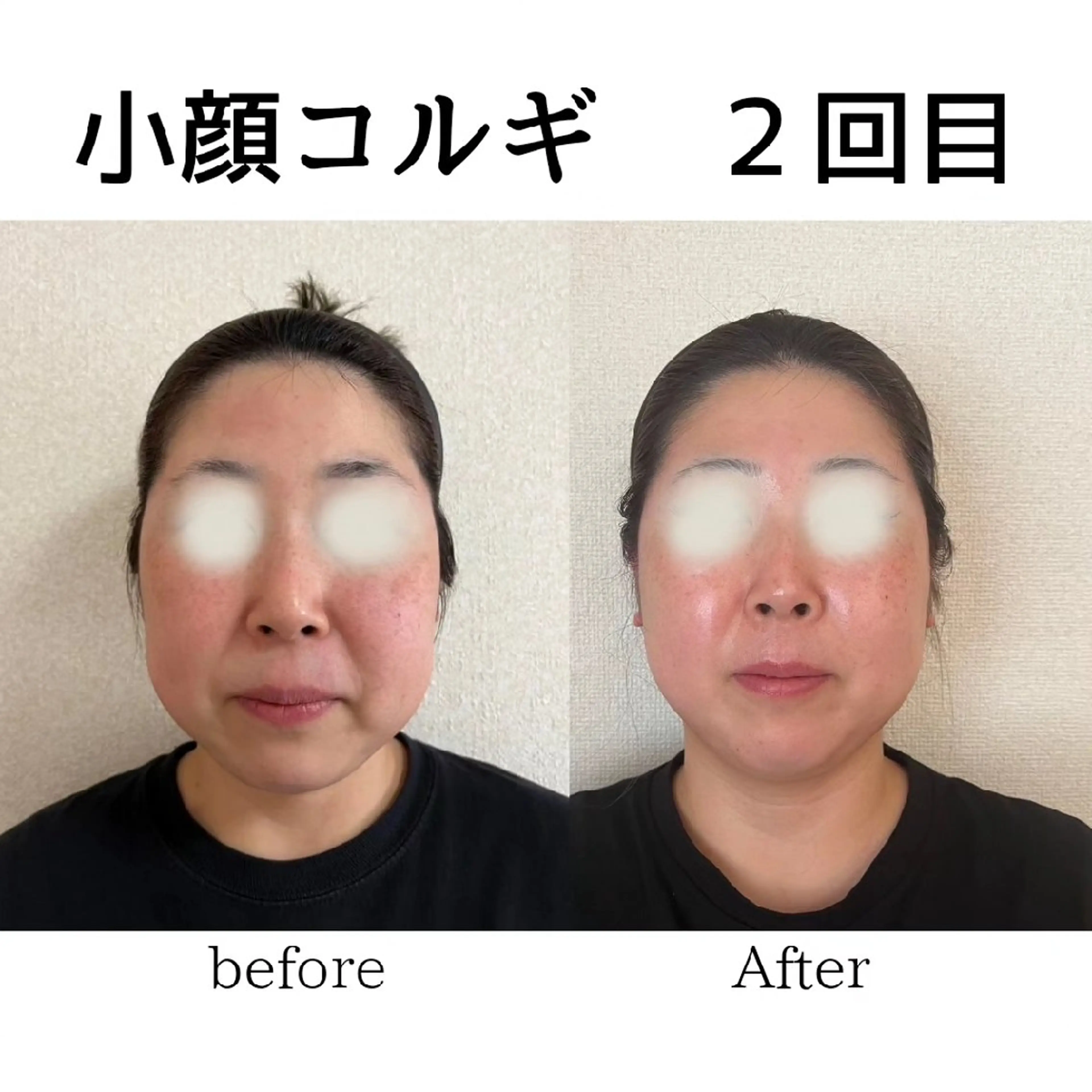 小顔コルギ&肌質改善 の専門店LIBREのエステ・リラクイメージ