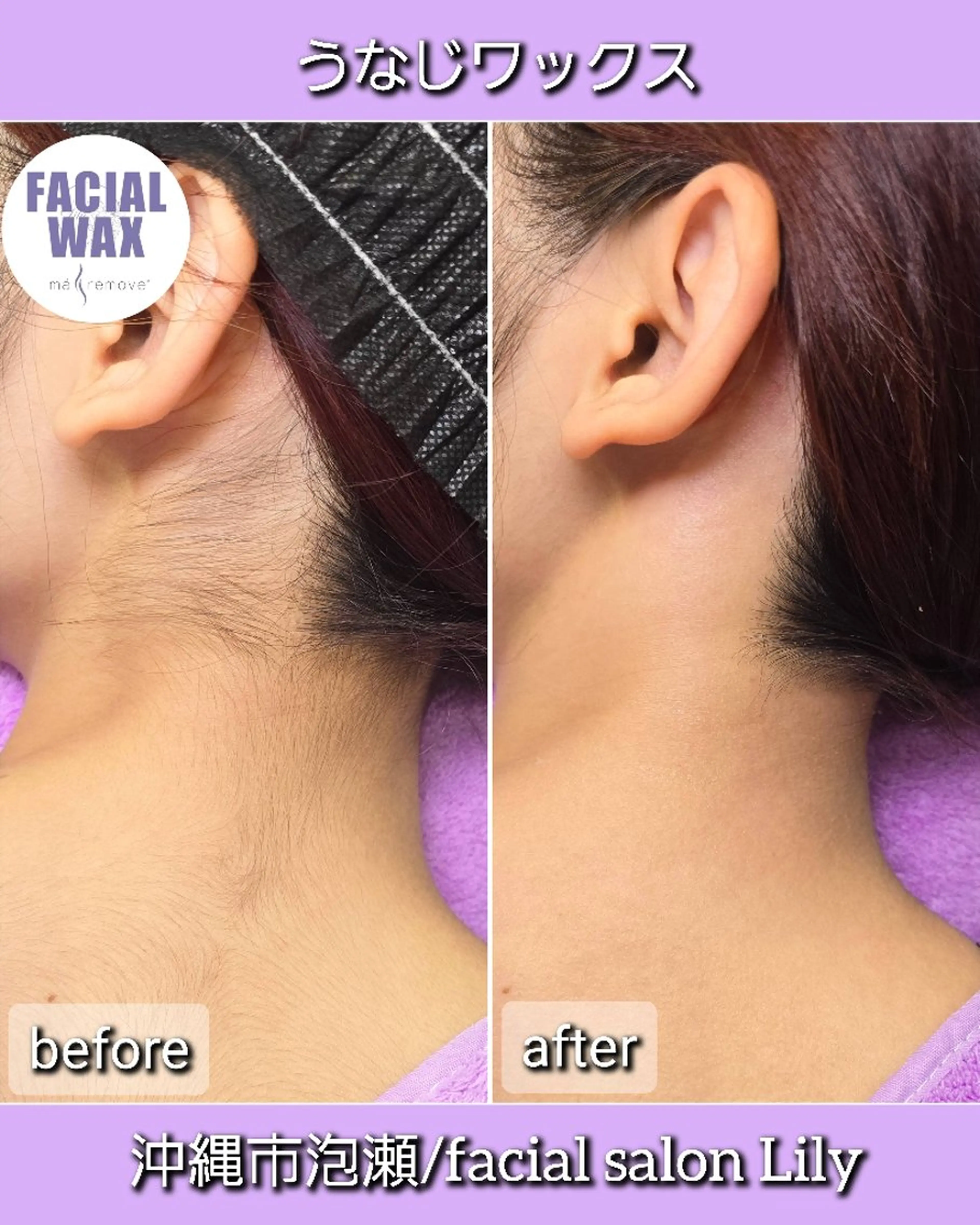 脱毛 facial salon Lily所属・salon Lilyのエステ・リラクイメージ