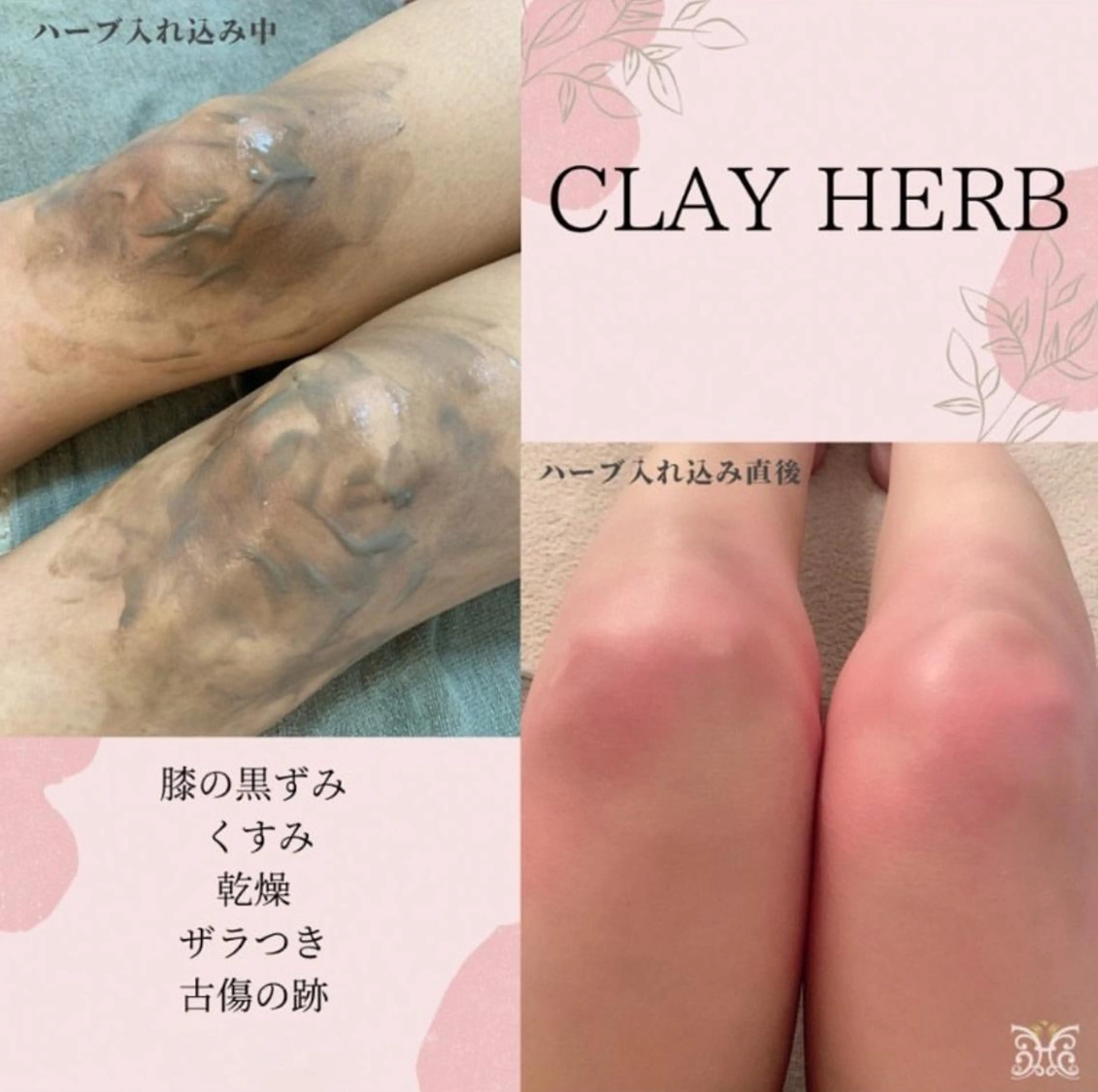 美肌&アロマ🌸 nana 中目黒のエステ・リラクイメージ