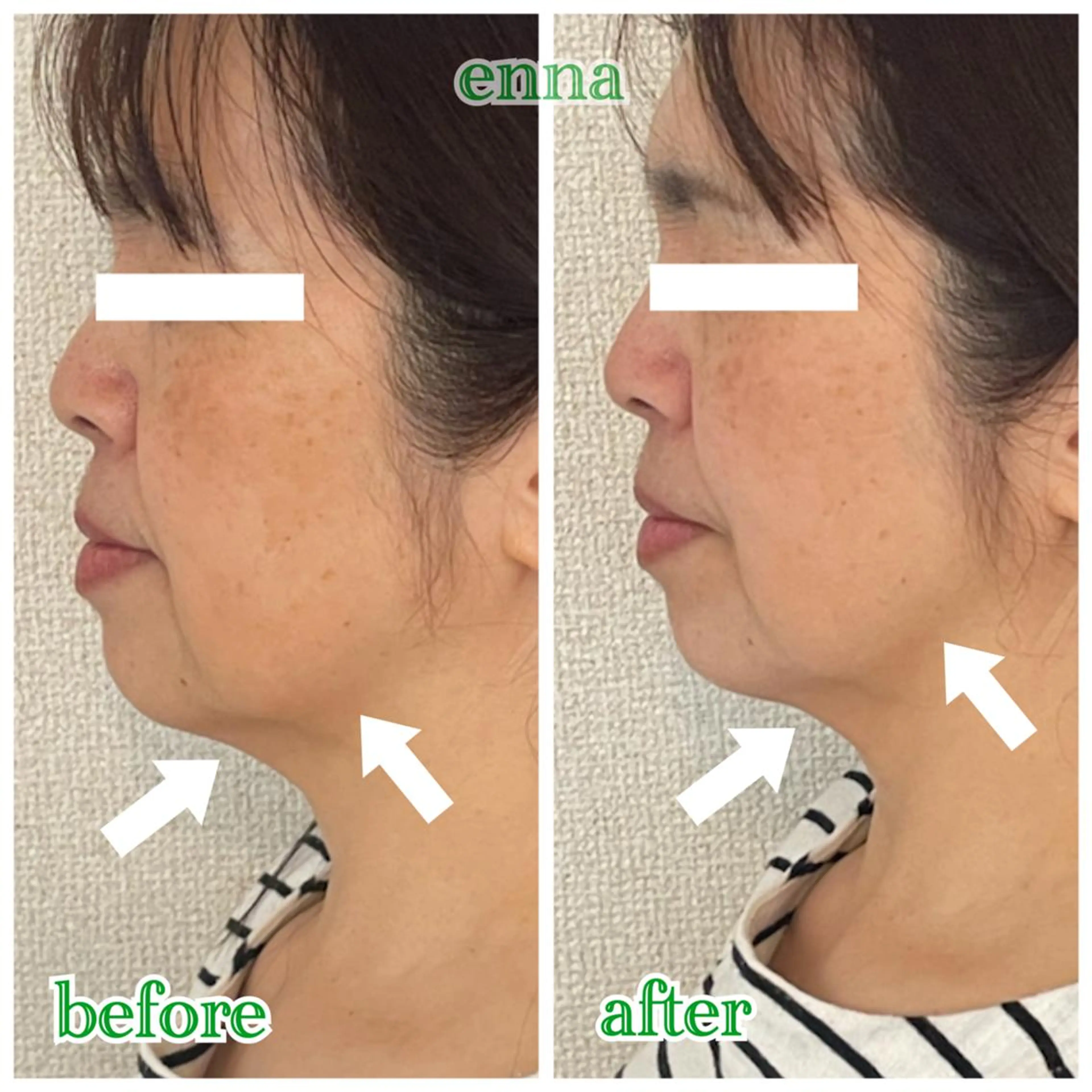 三上 笑里奈のエステ・リラクイメージ