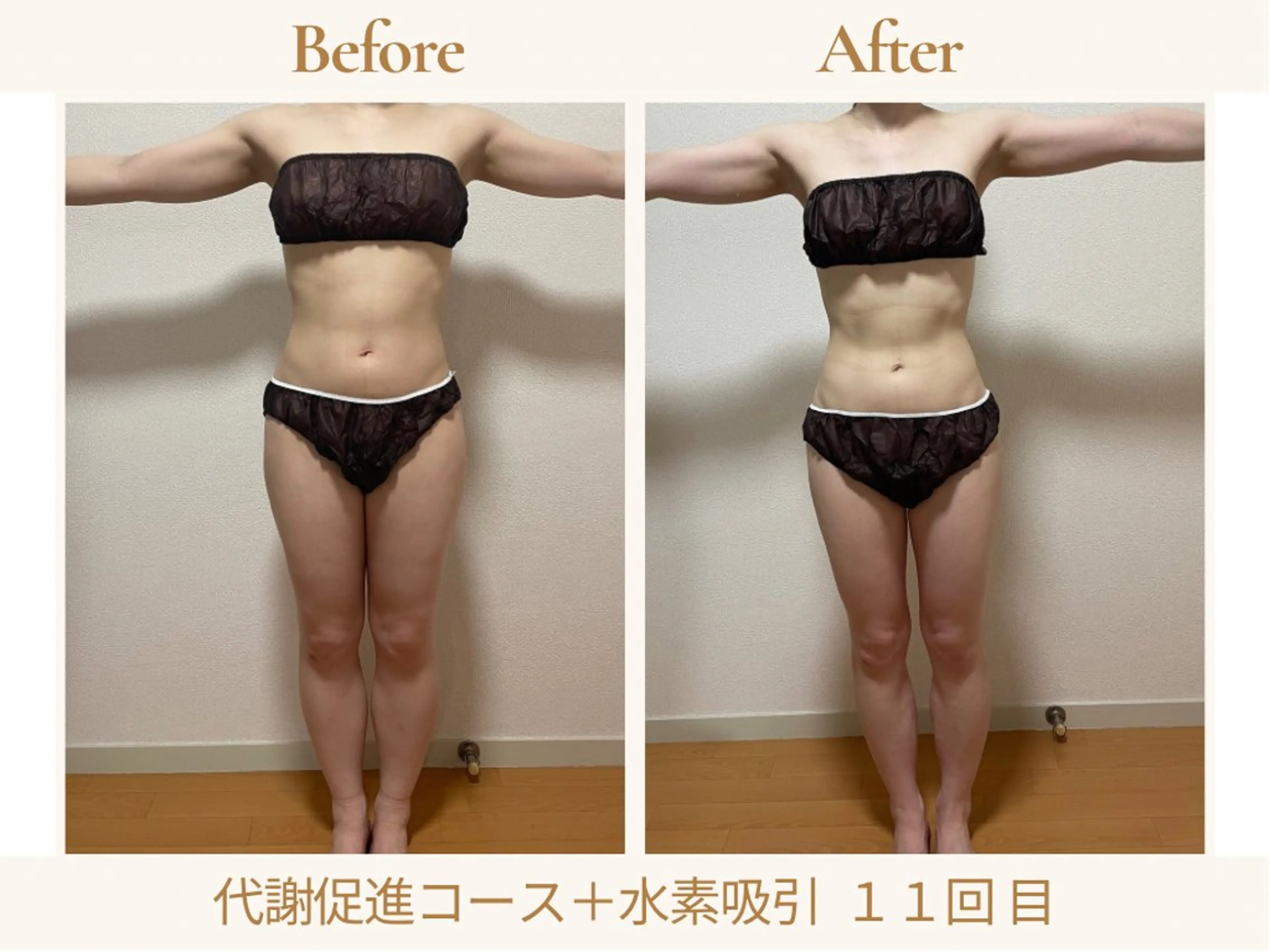 エステ リラク あみ|痩身の最先端 よもぎ蒸しサロン大塚のエステ・リラクイメージ