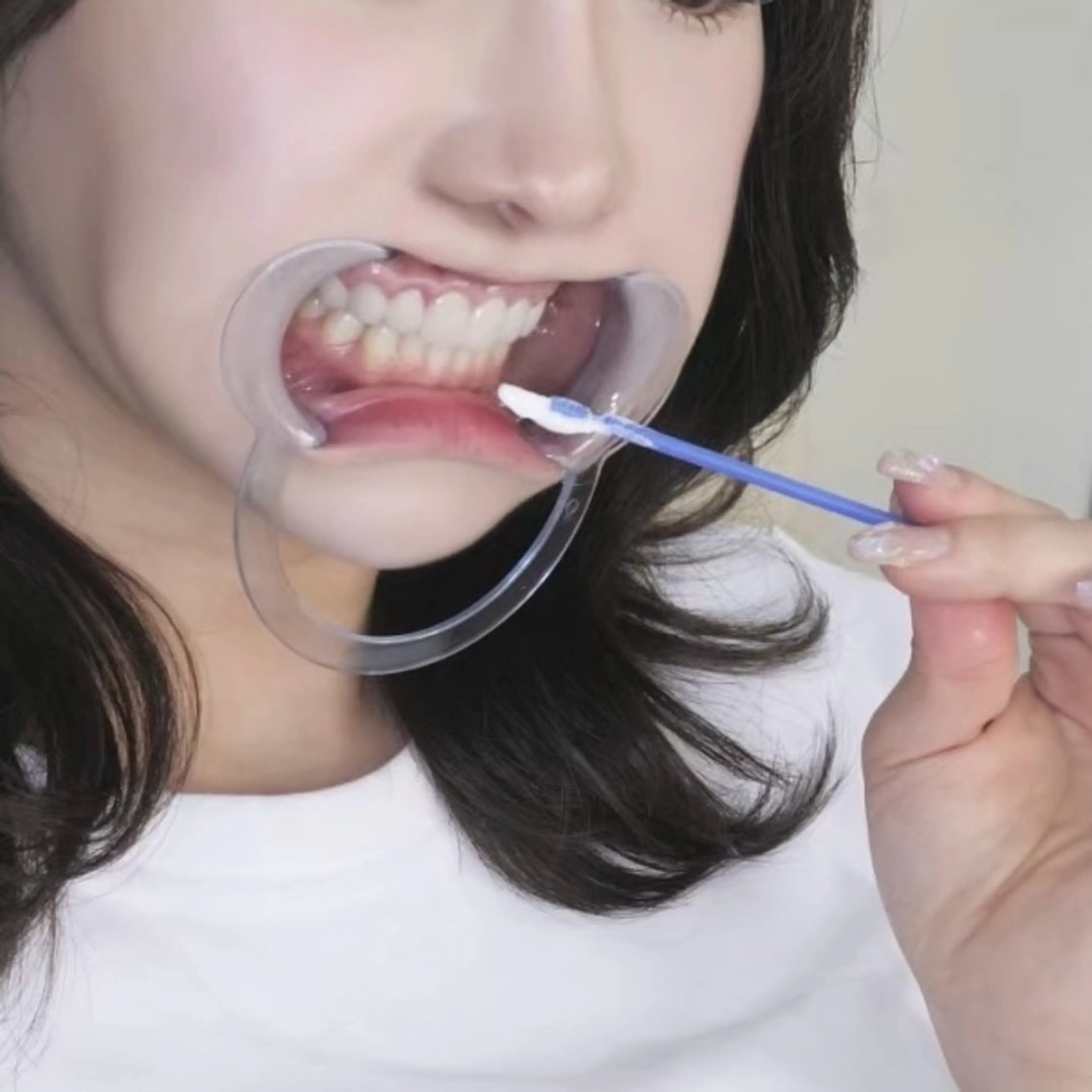 その他 セルフホワイトニング 都立大学🦷✴︎のその他イメージ