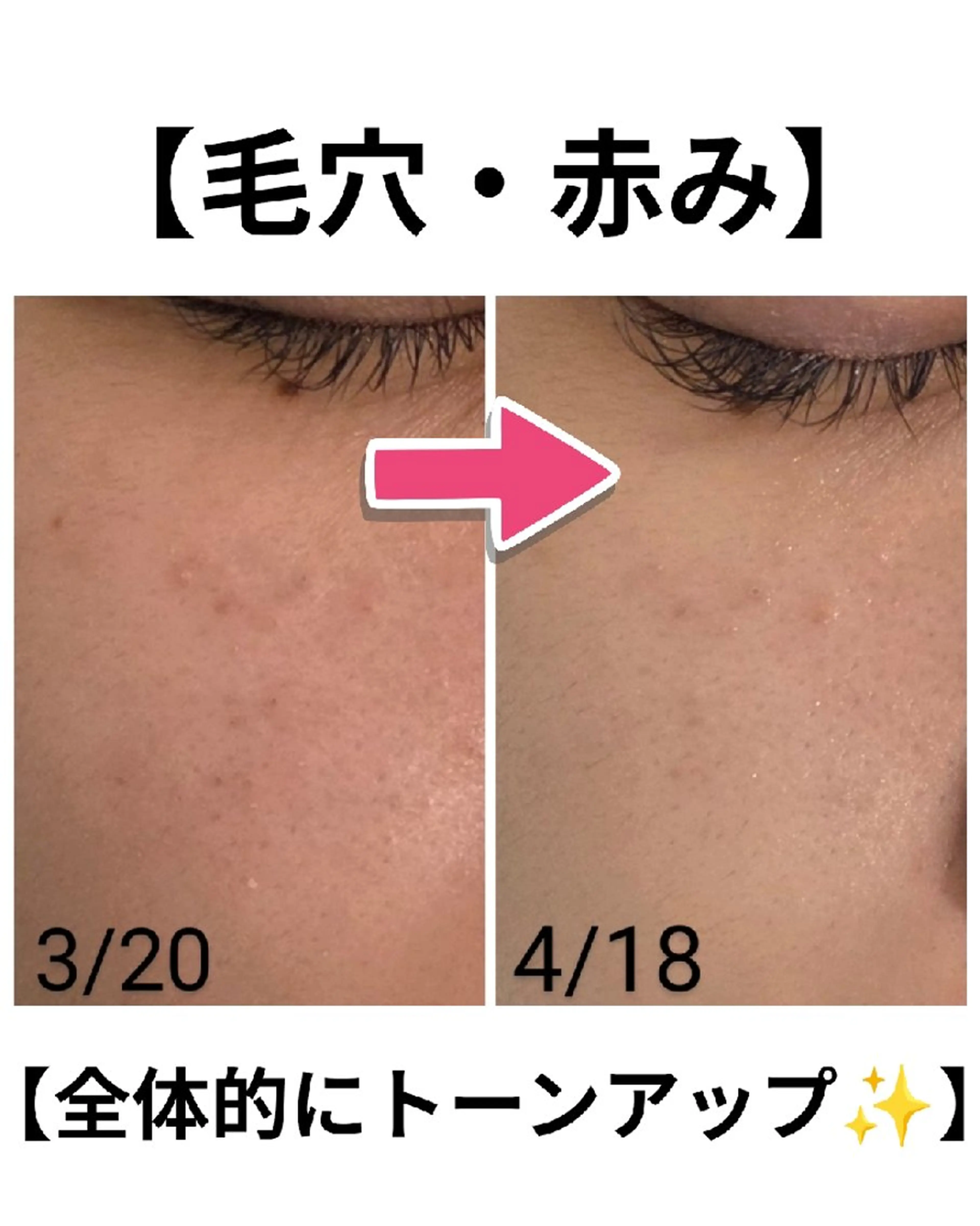 エステ 上尾Luce. あきやまのエステ・リラクイメージ