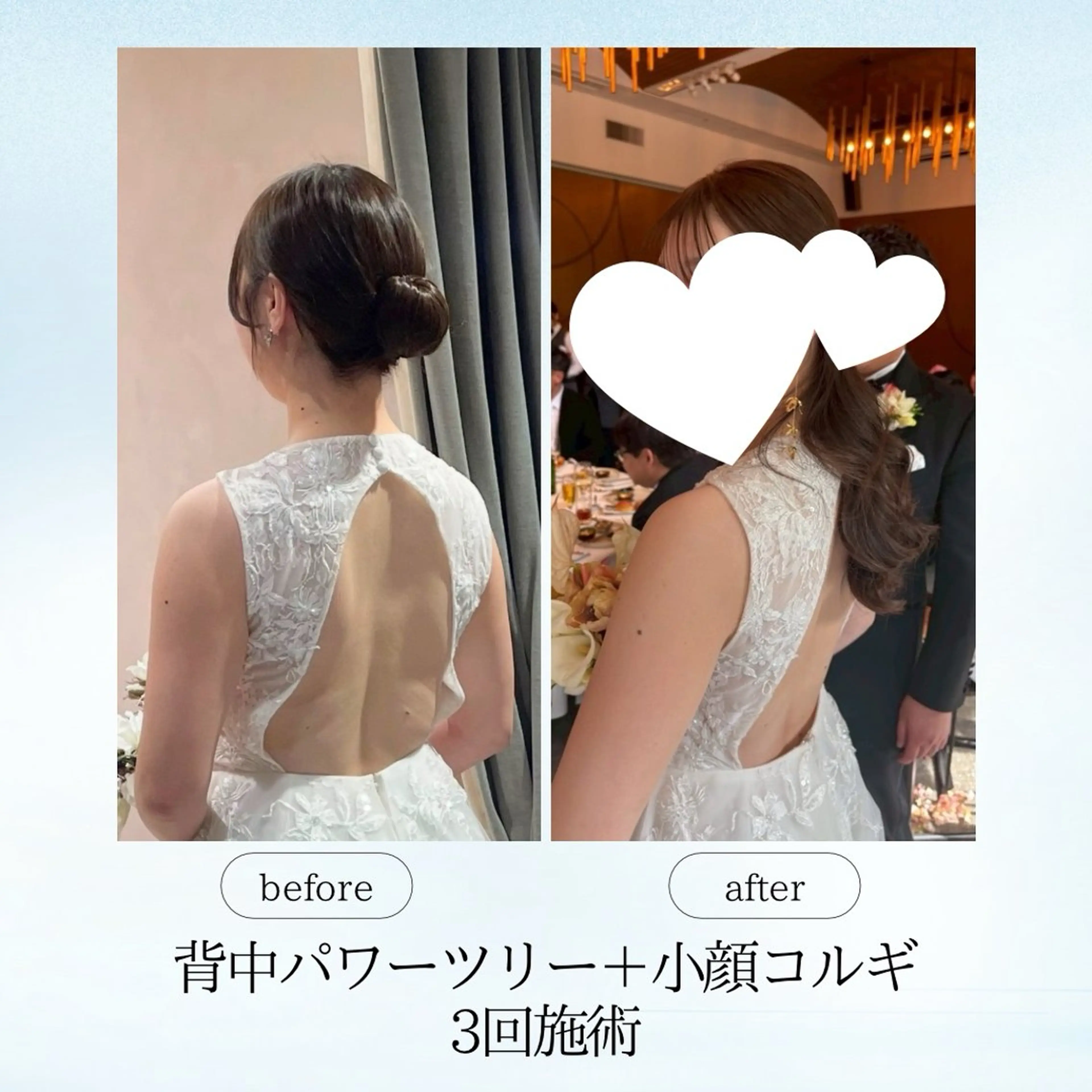 エステ リラク 《痩身、小顔専門店》 エスプレッソのエステ・リラクイメージ