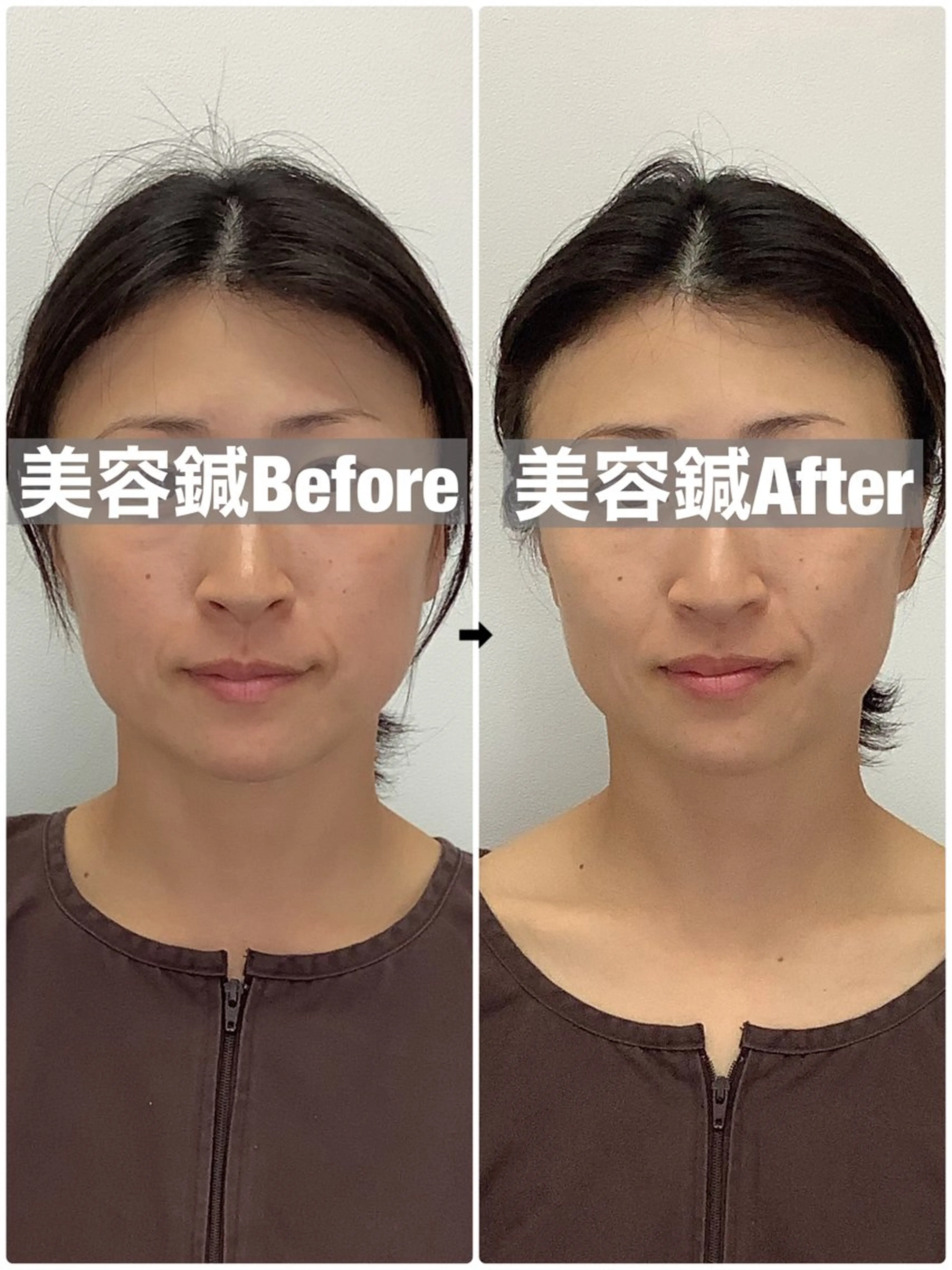 エステ リラク ハリサロンドオフ 美容鍼灸×小顔整体のエステ・リラクイメージ