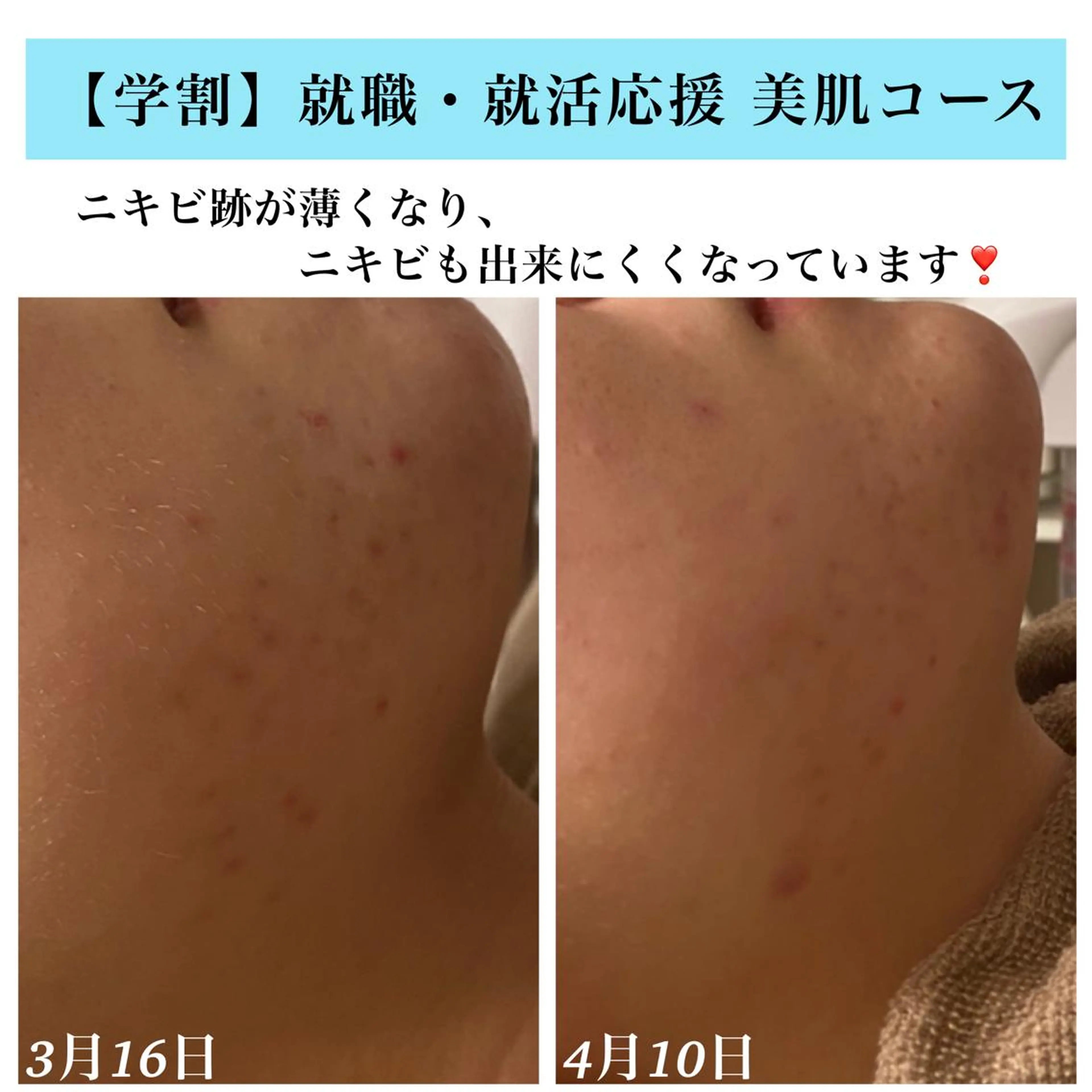 エステ Bellesthe （ベルエステ）のエステ・リラクイメージ