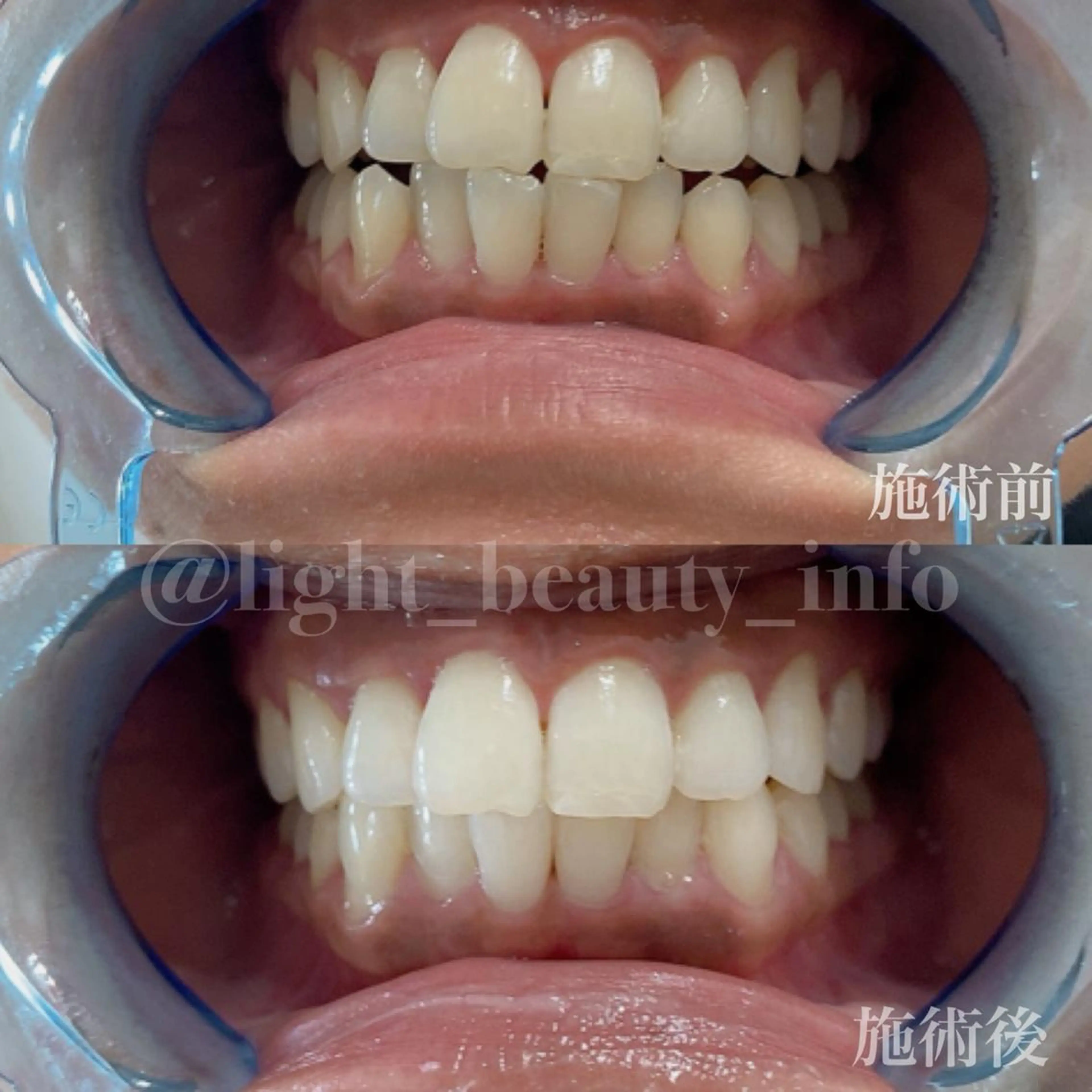 ライトビューティー 銀座店のエステ・リラクイメージ