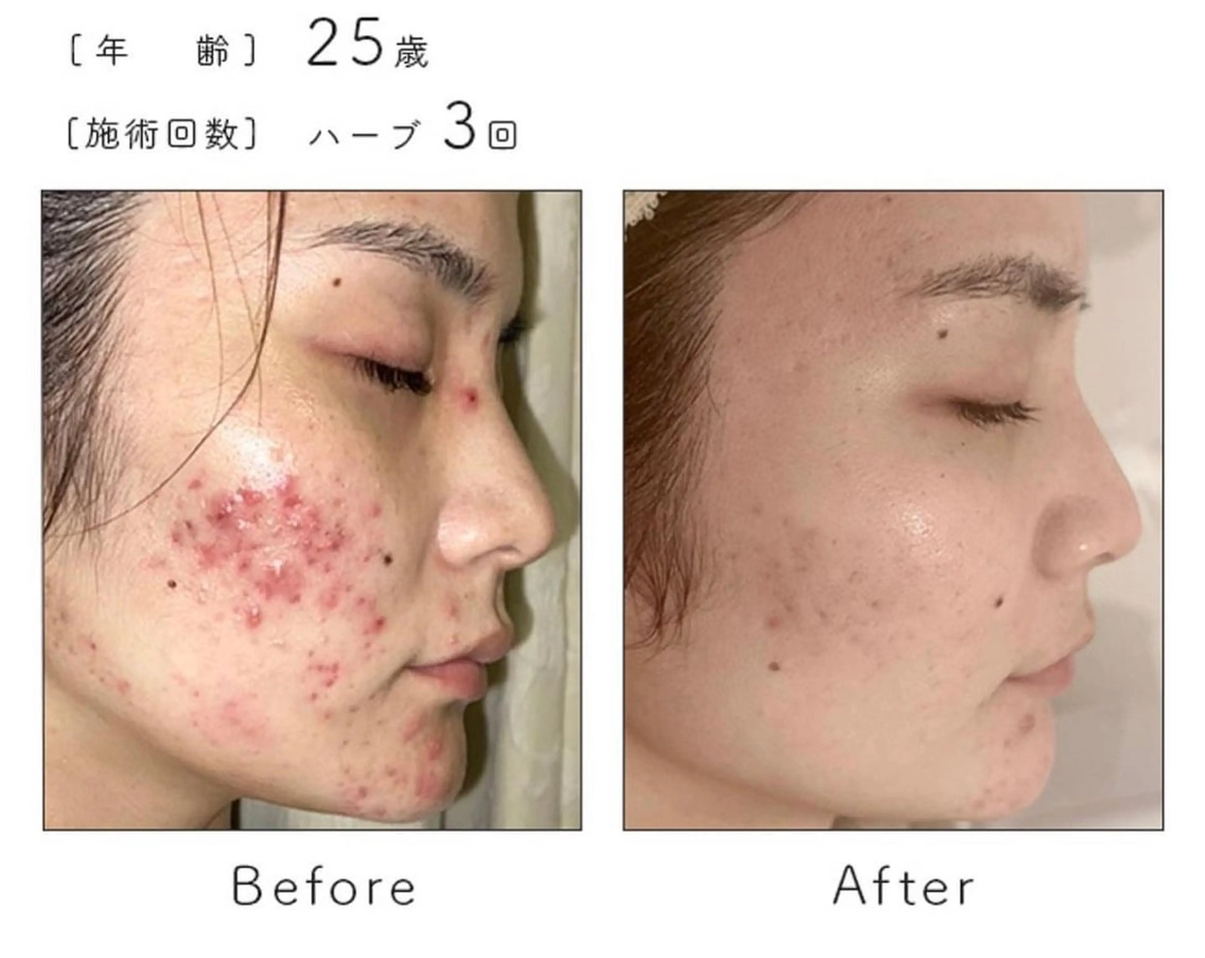 エステ SALON BioBioのエステ・リラクイメージ