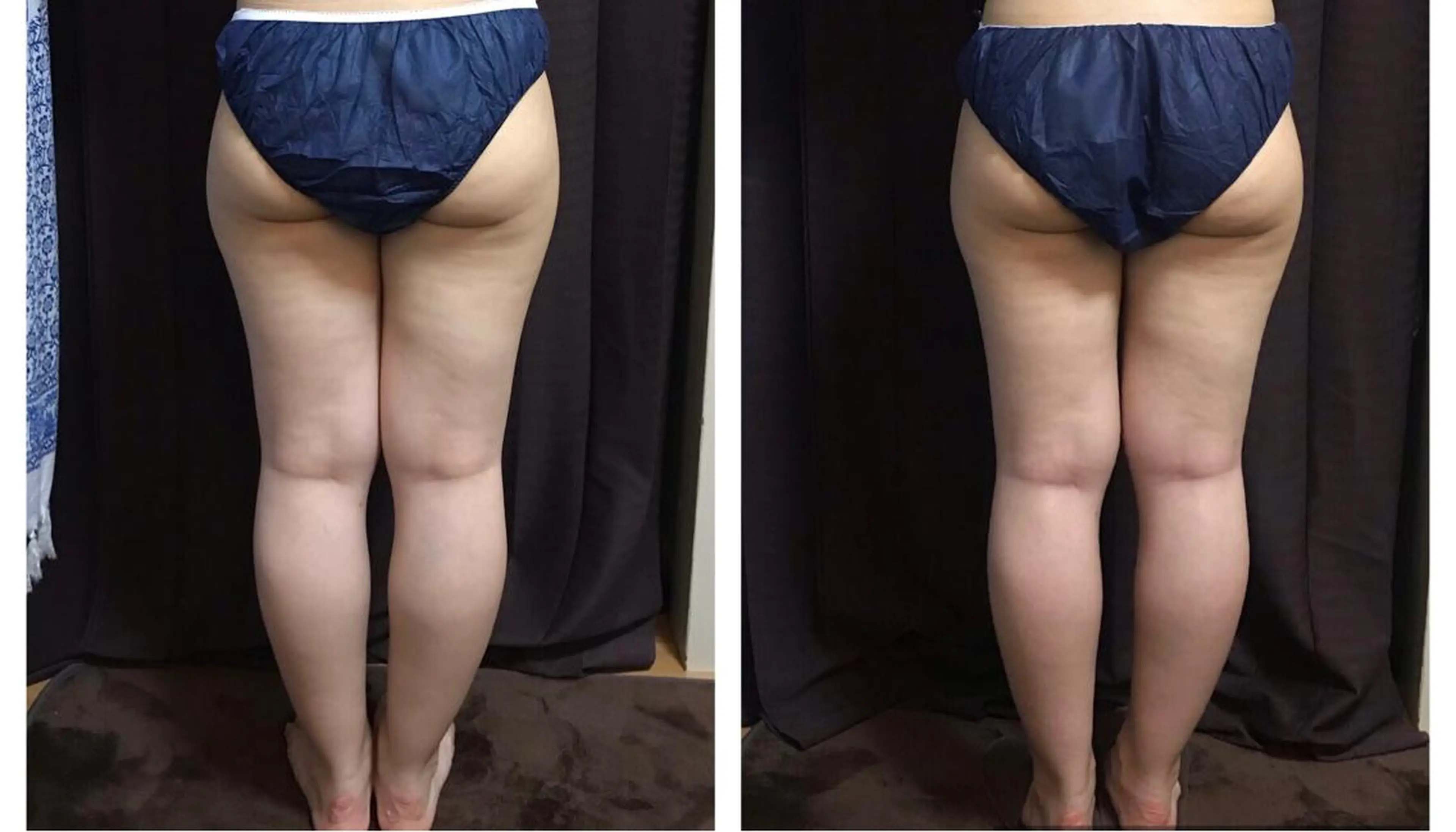 エステ リラク warmthオーナー Harunaのエステ・リラクイメージ