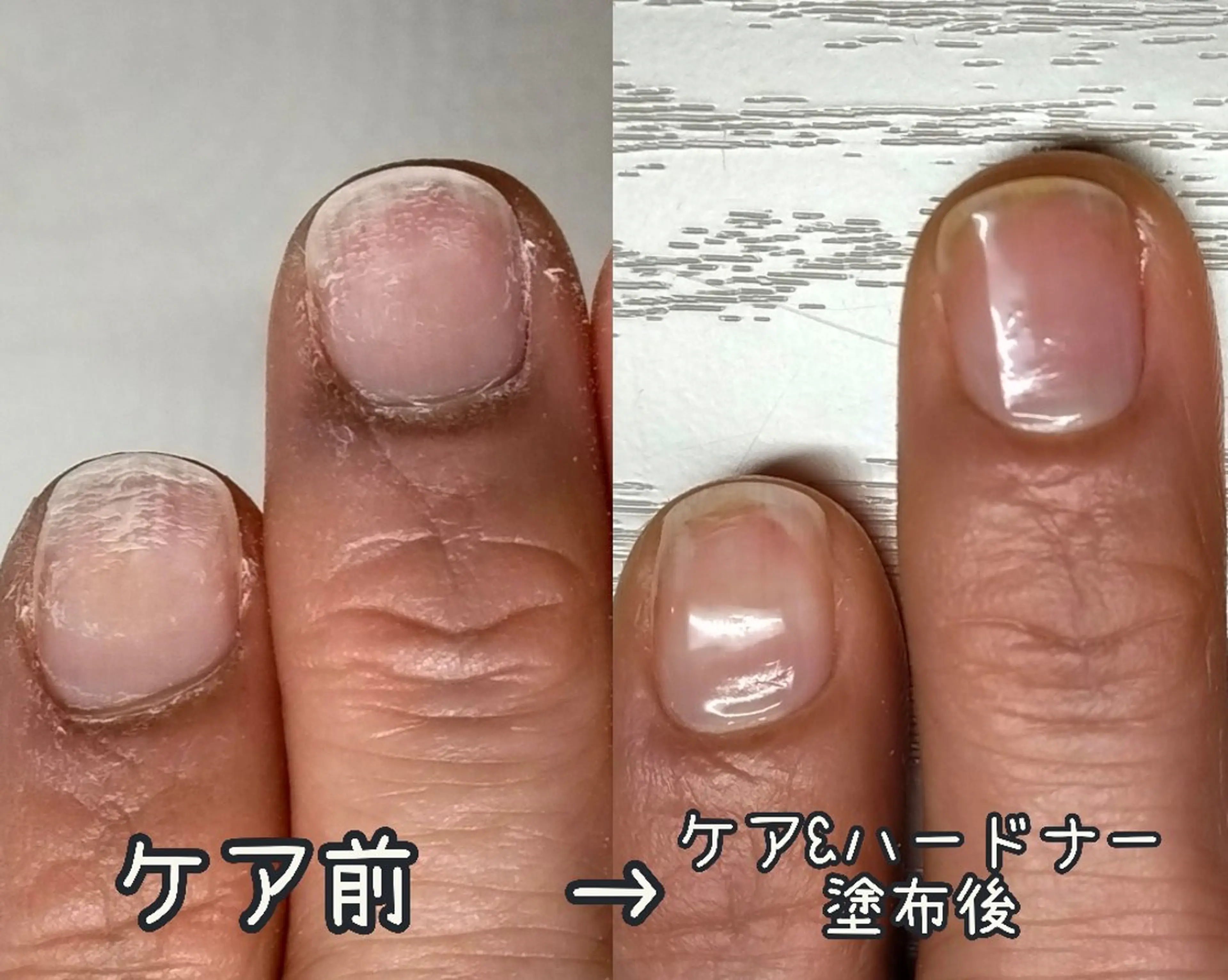 自爪育成ハンドケア【ファイリング+甘皮処理(ウォーターケア)+ハードナー塗布】の写真