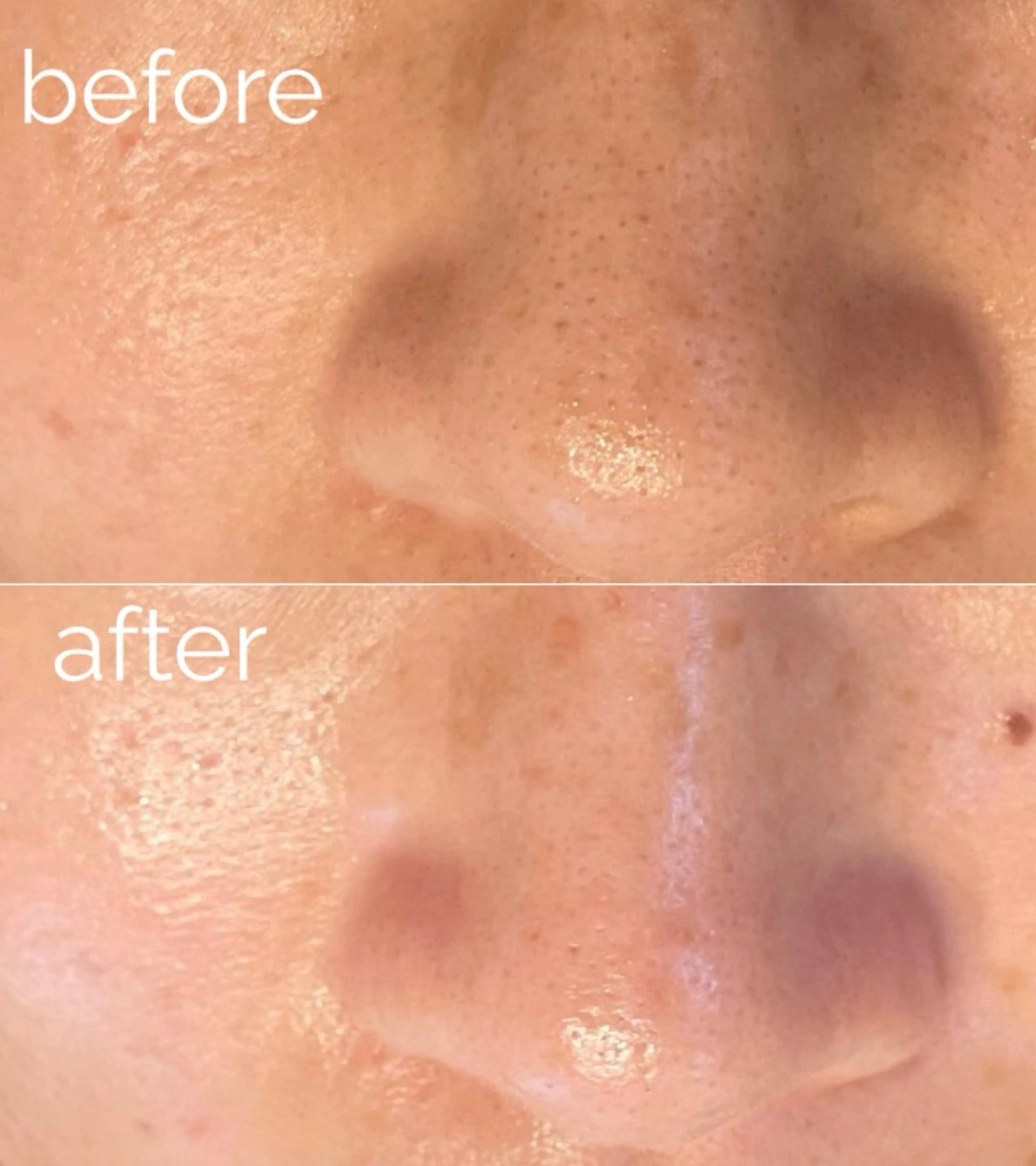 毛穴ケア専門サロン m&uのエステ・リラクイメージ