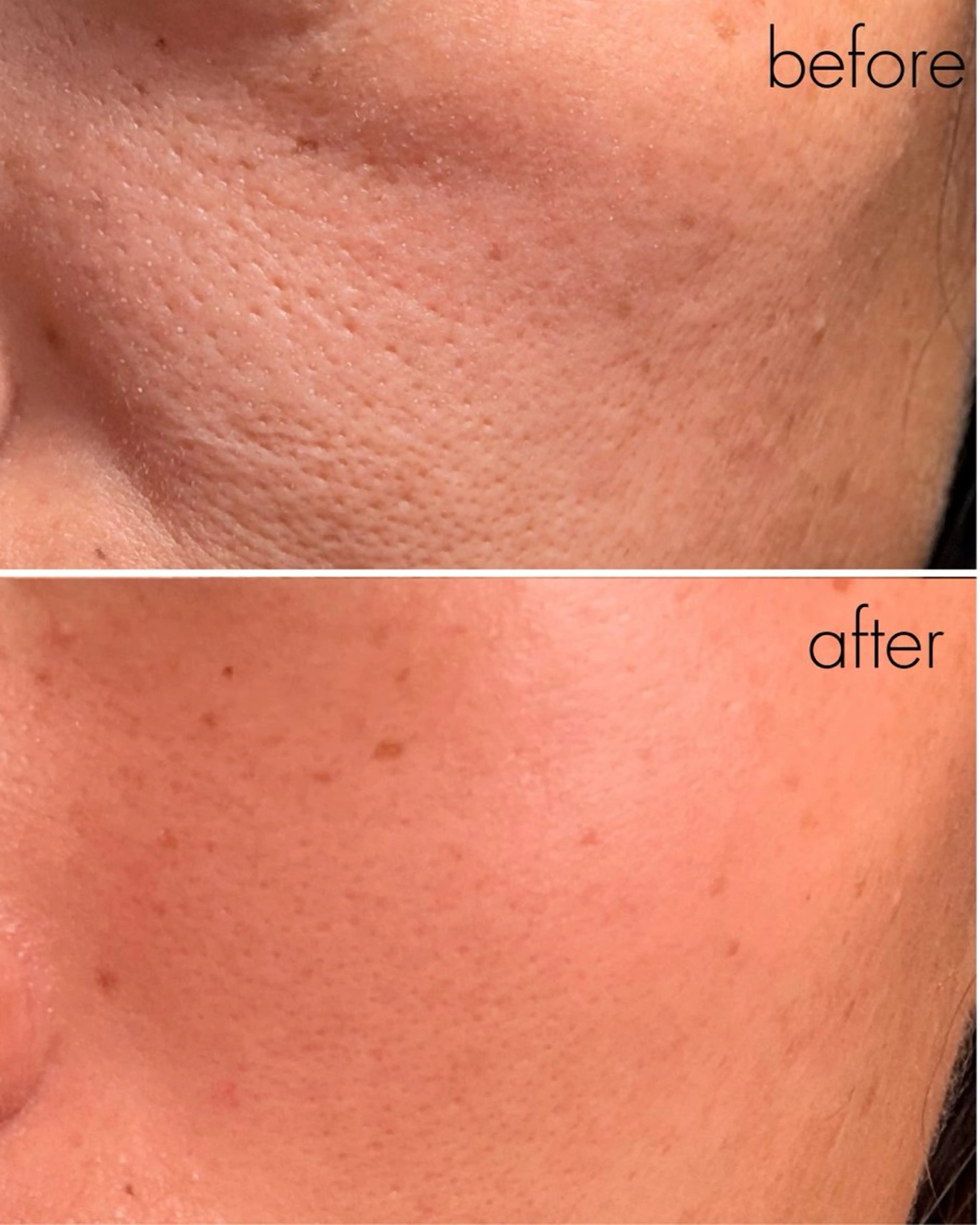 脱毛 糸除毛専門salon acoのエステ・リラクイメージ