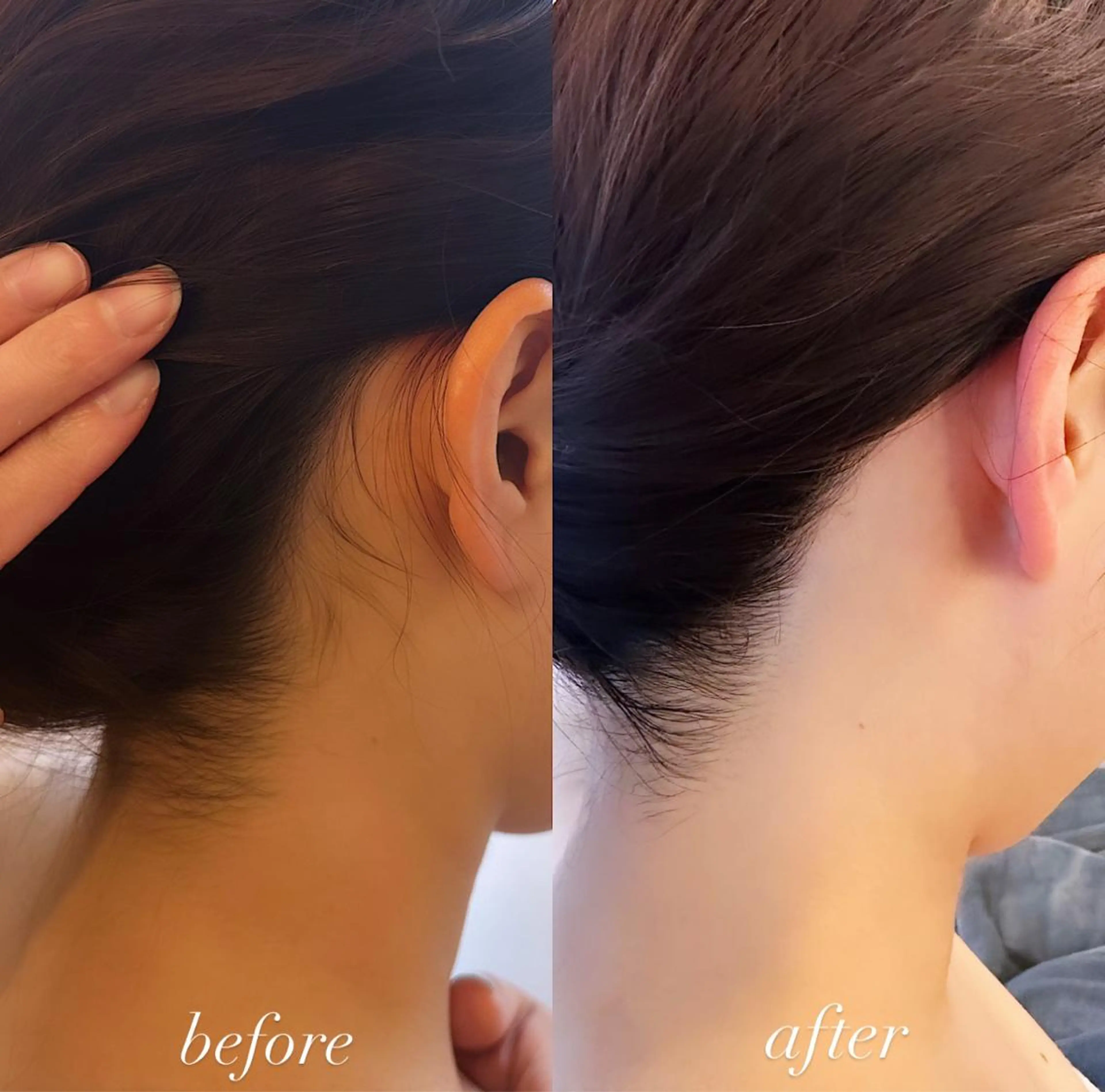 うなじ脱毛/美肌脱毛 LABELのエステ・リラクイメージ