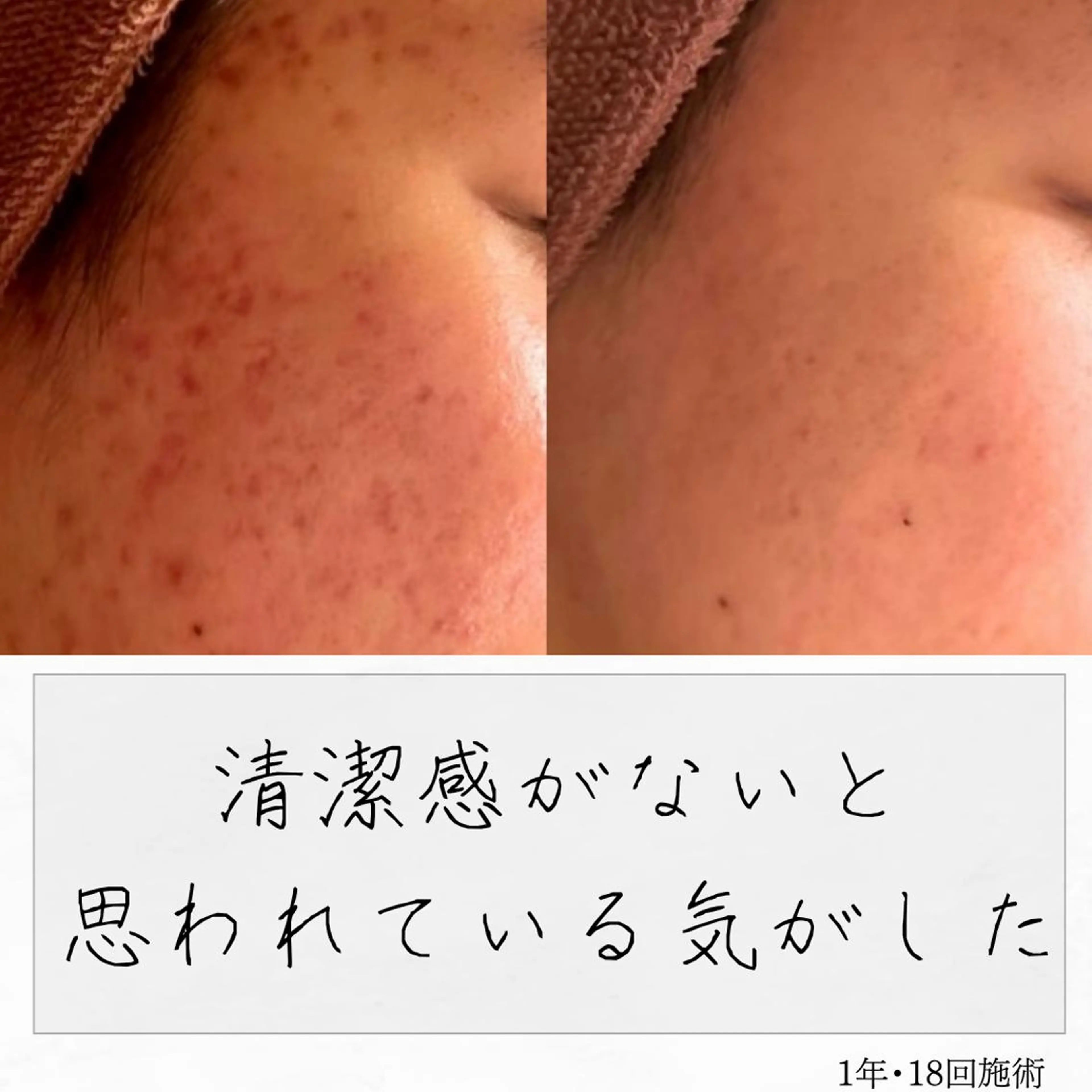 ニキビ経験者が施術 する専門サロン🌻のエステ・リラクイメージ