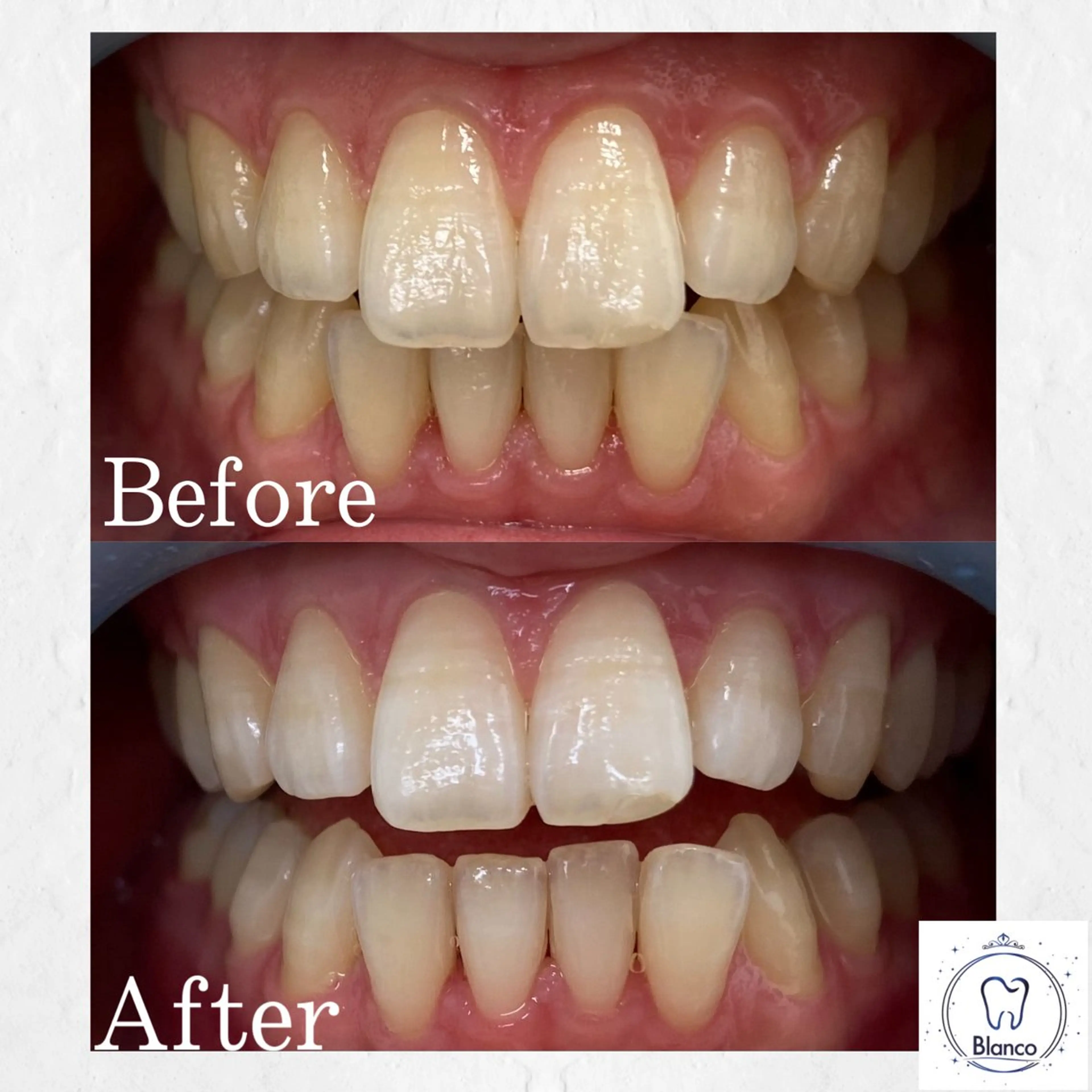 その他 Blanco 川口駅前店のその他イメージ