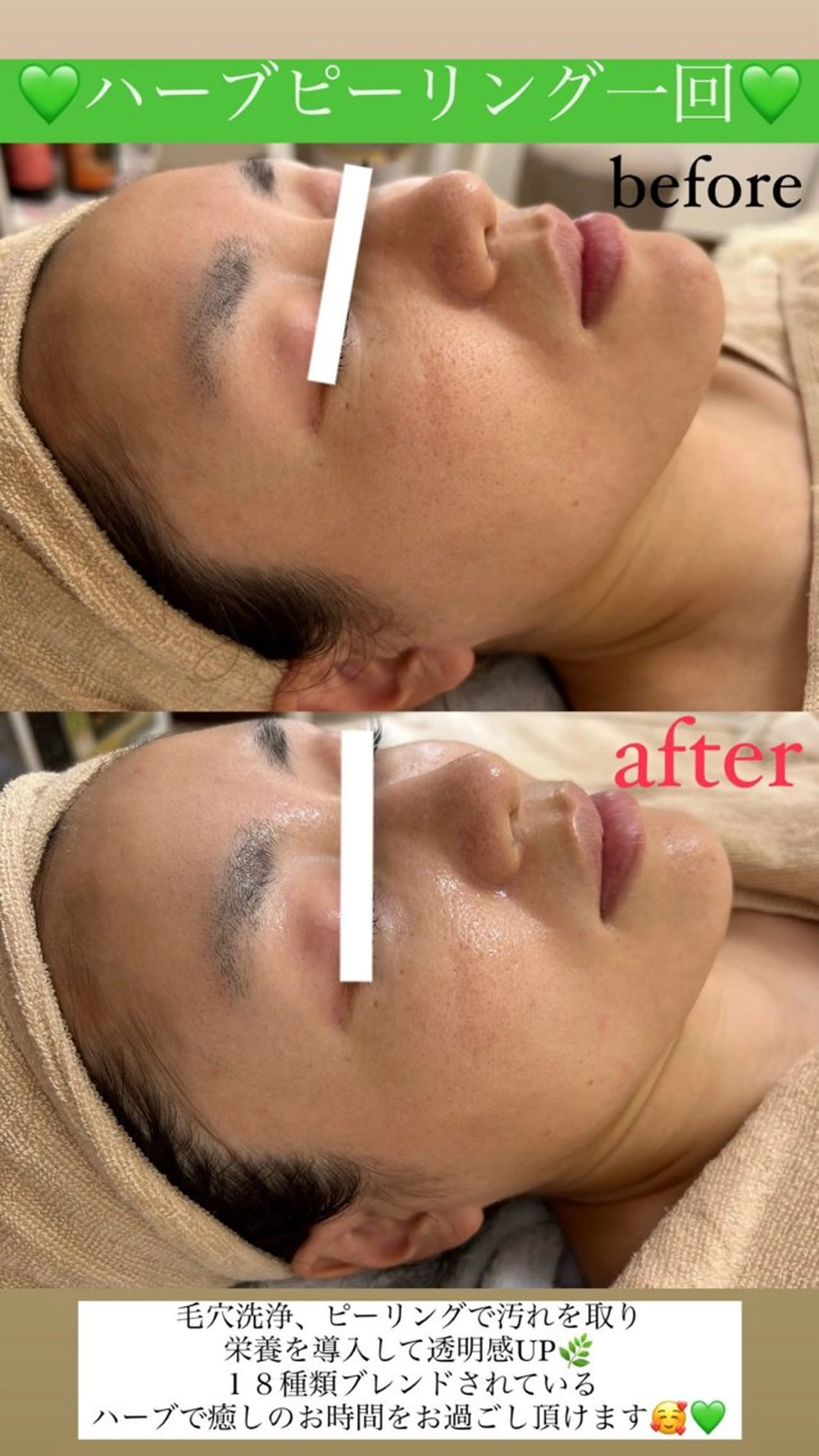 メンズ エステ Salon de Lino 御器所のエステ・リラクイメージ