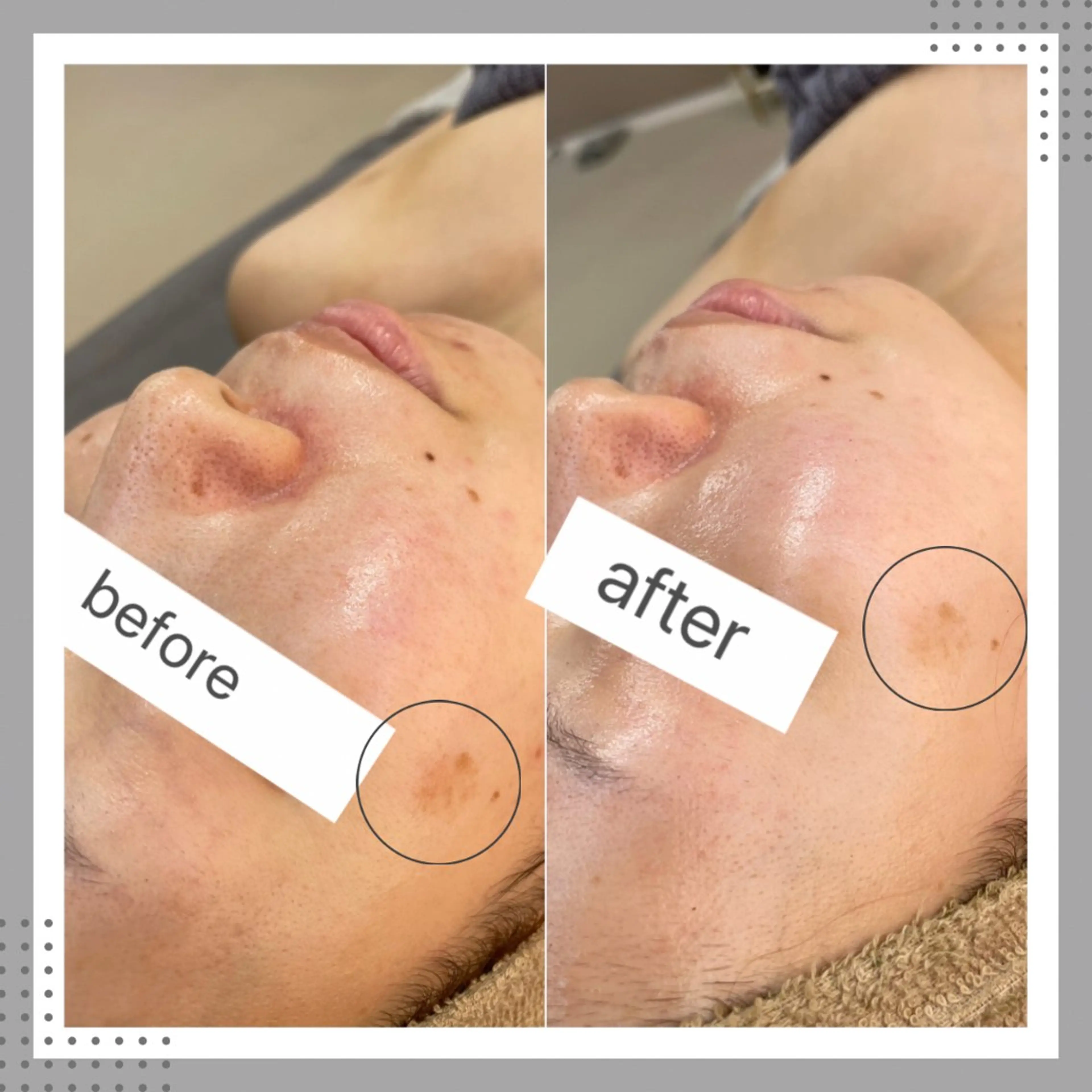 エステ プライベートサロン amberのエステ・リラクイメージ