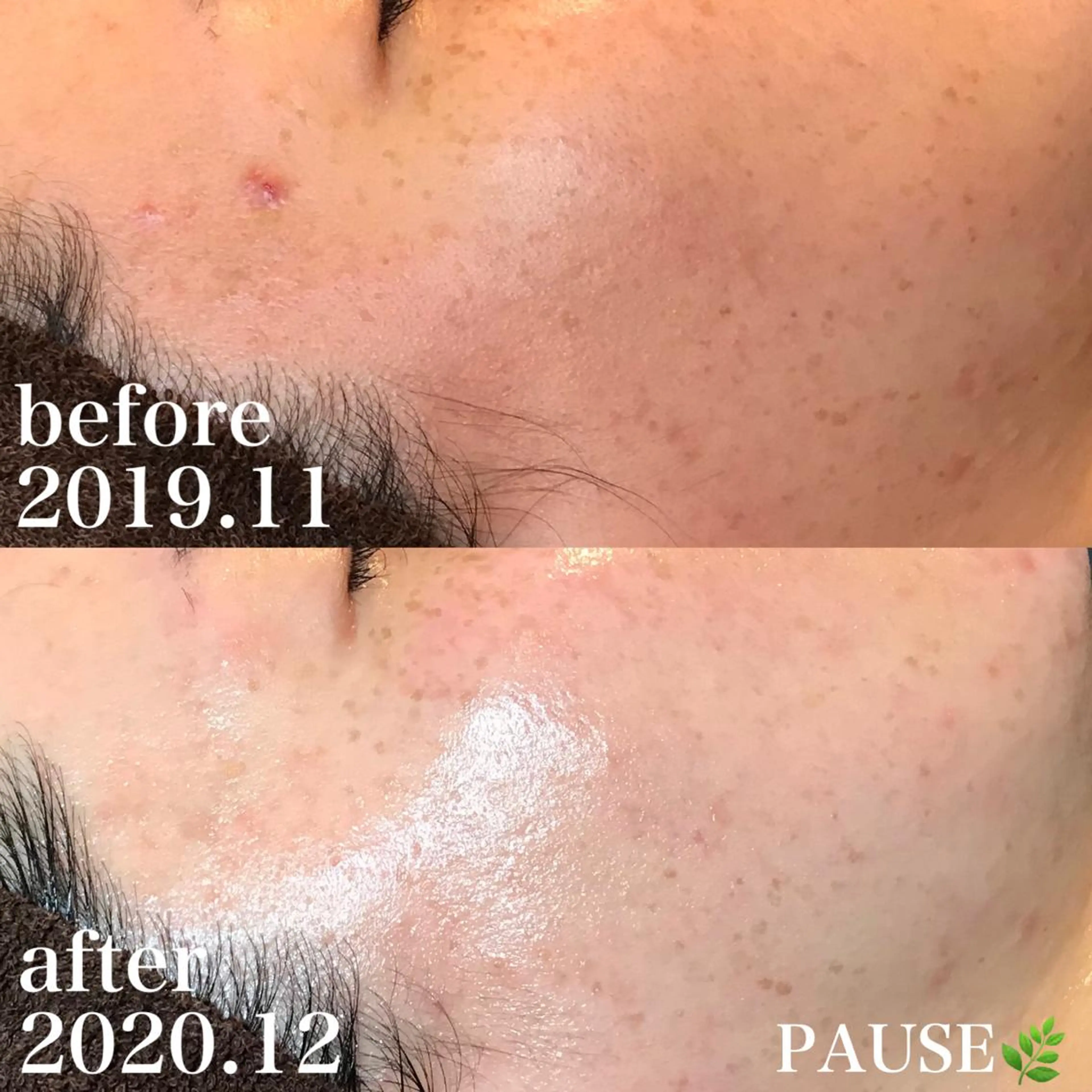 エステ 浜野 恵美のエステ・リラクイメージ