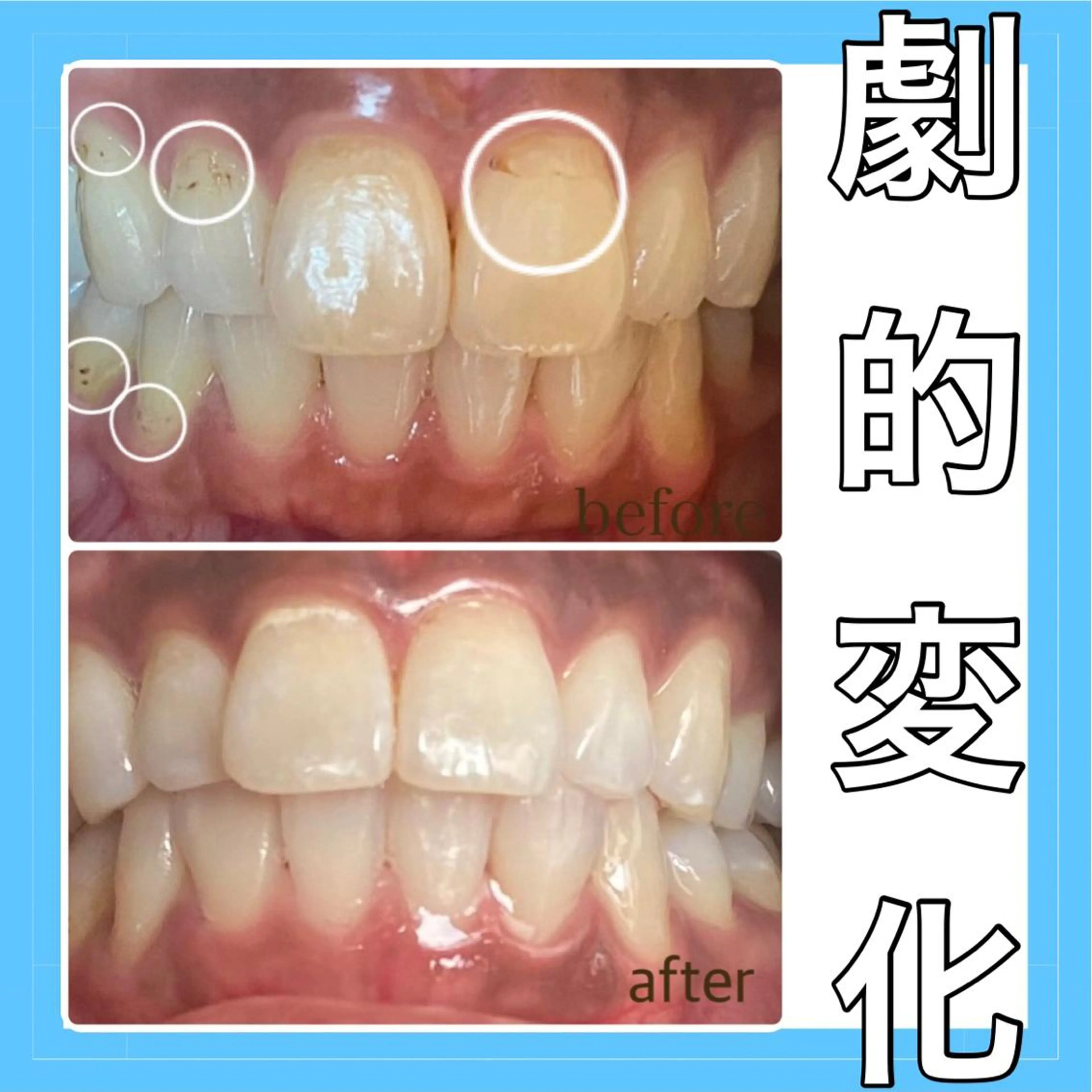 美人スイッチdiet スーパージェクションのその他イメージ