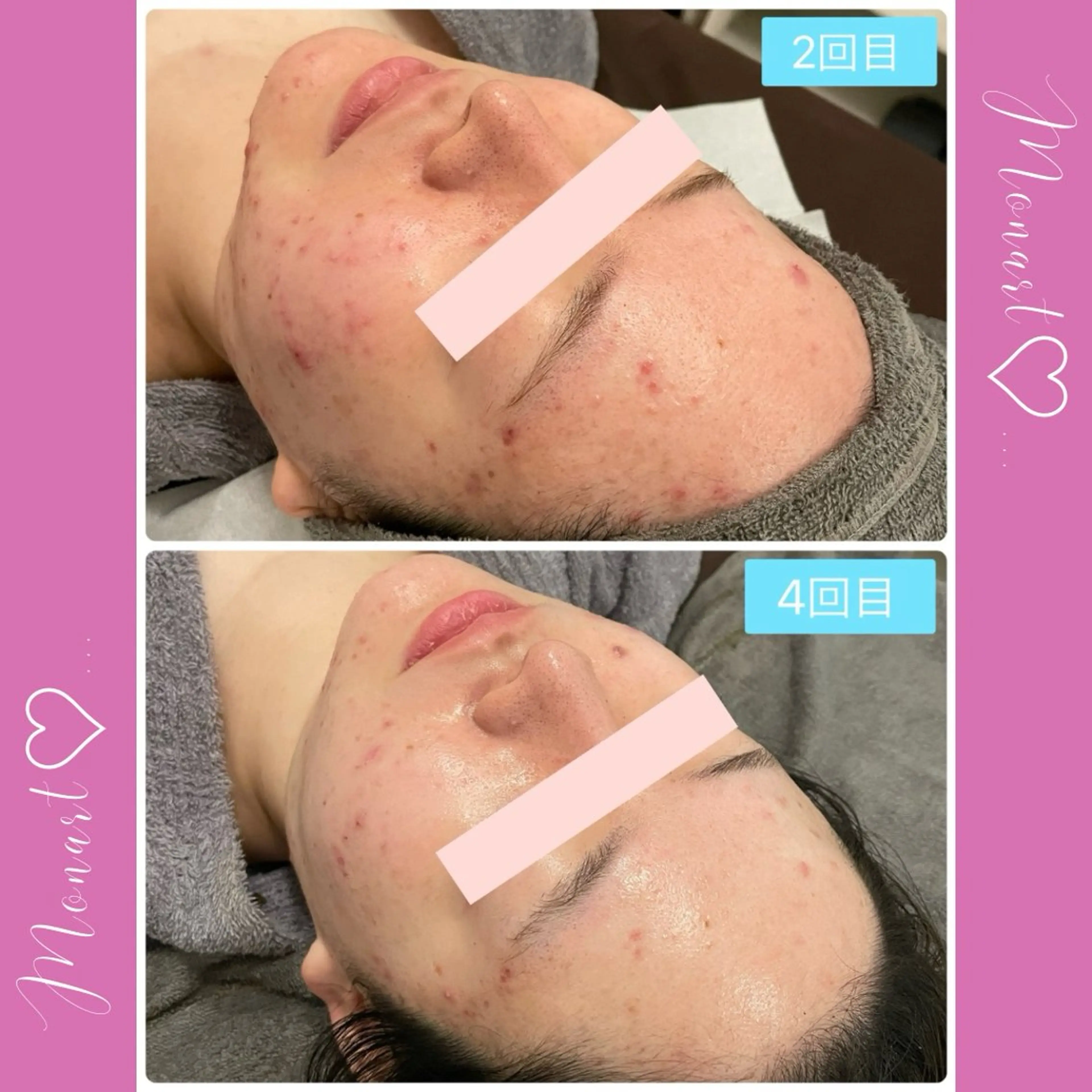 Monart -deux-のエステ・リラクイメージ