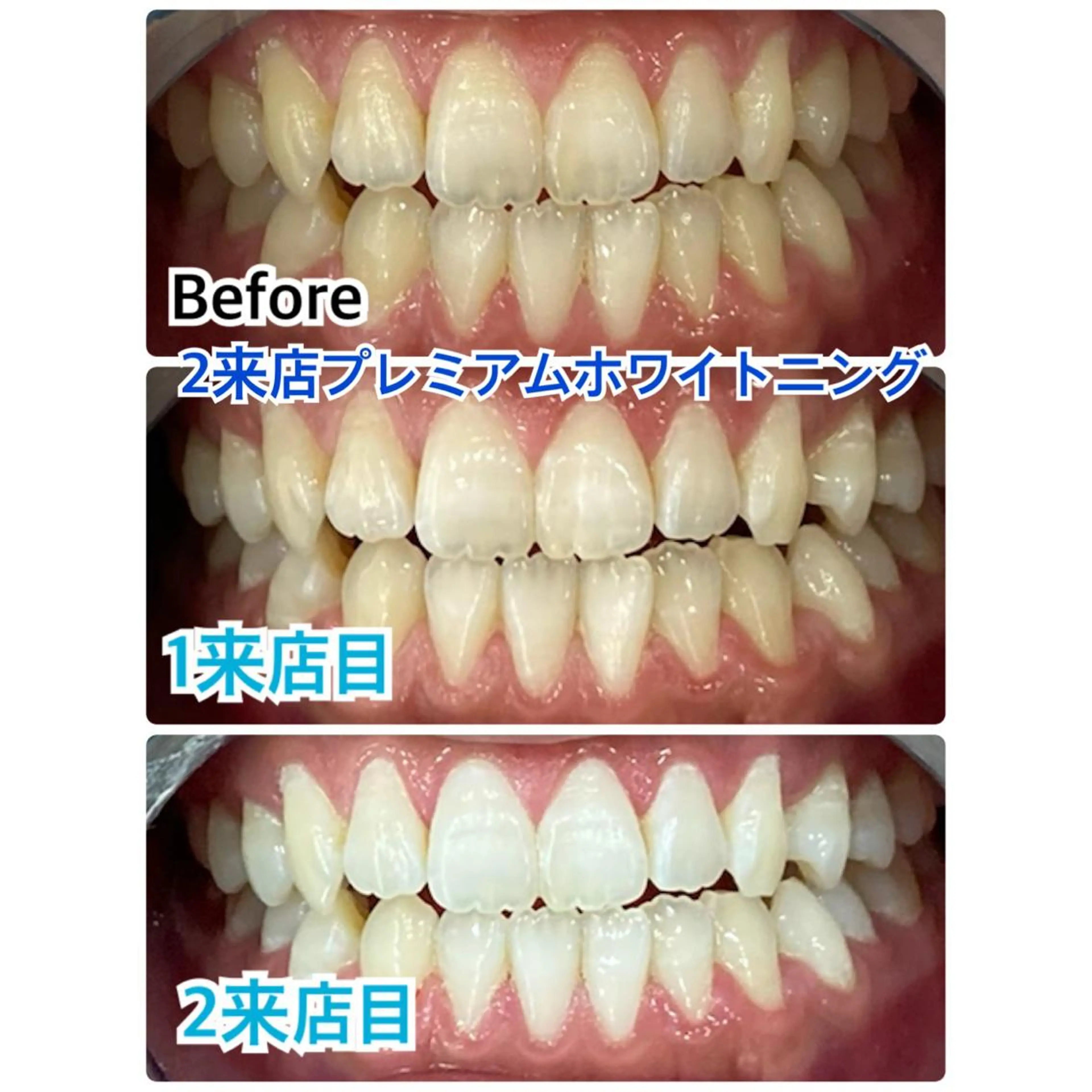 プラチナムビューティー柏所属・【歯科提携】柏ホワイ トニングスタイルのその他イメージ