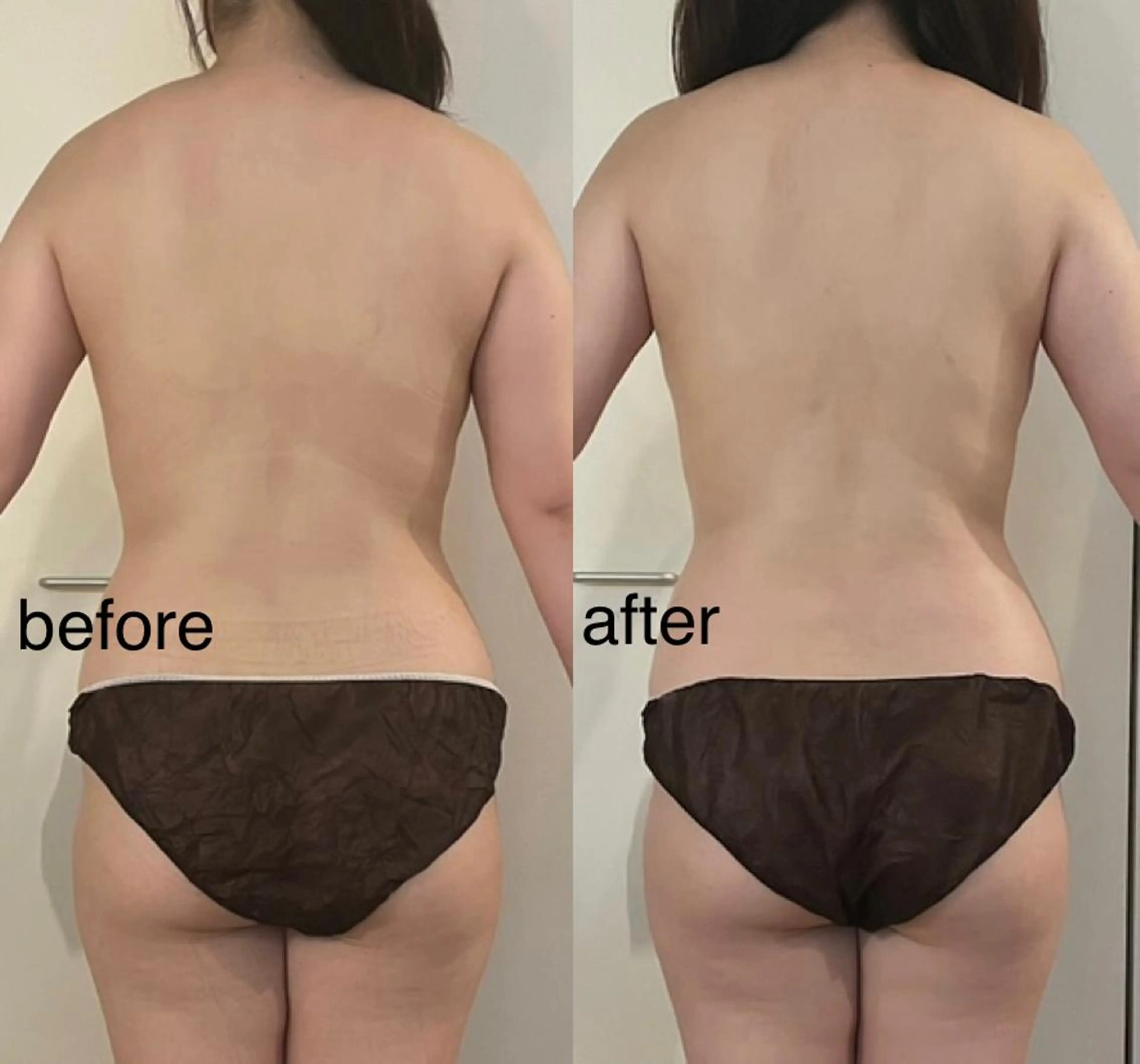 エステ リラク プライベートサロン シュシュのエステ・リラクイメージ