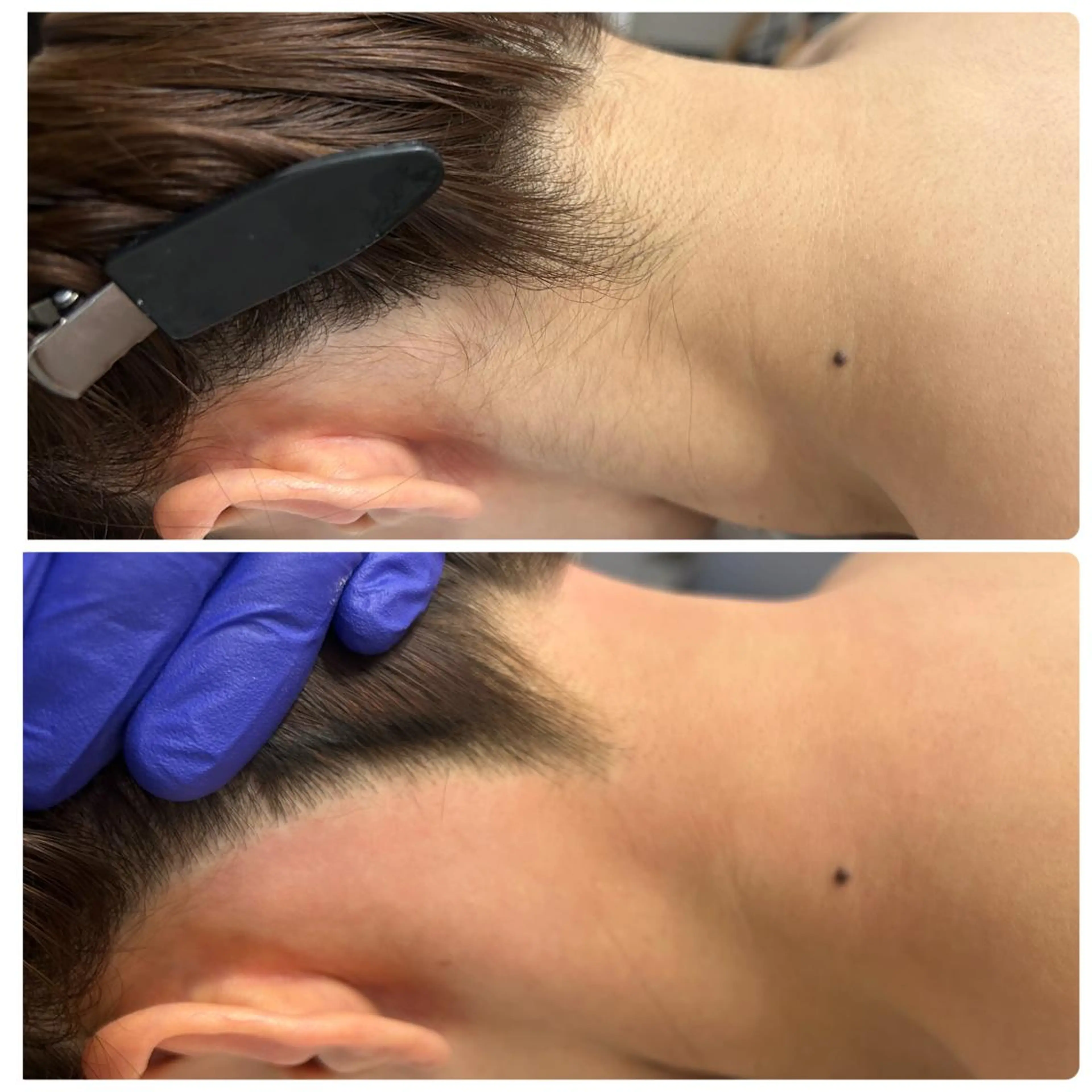 キッズ 脱毛 STELLAR. 谷岡恵里香のエステ・リラクイメージ