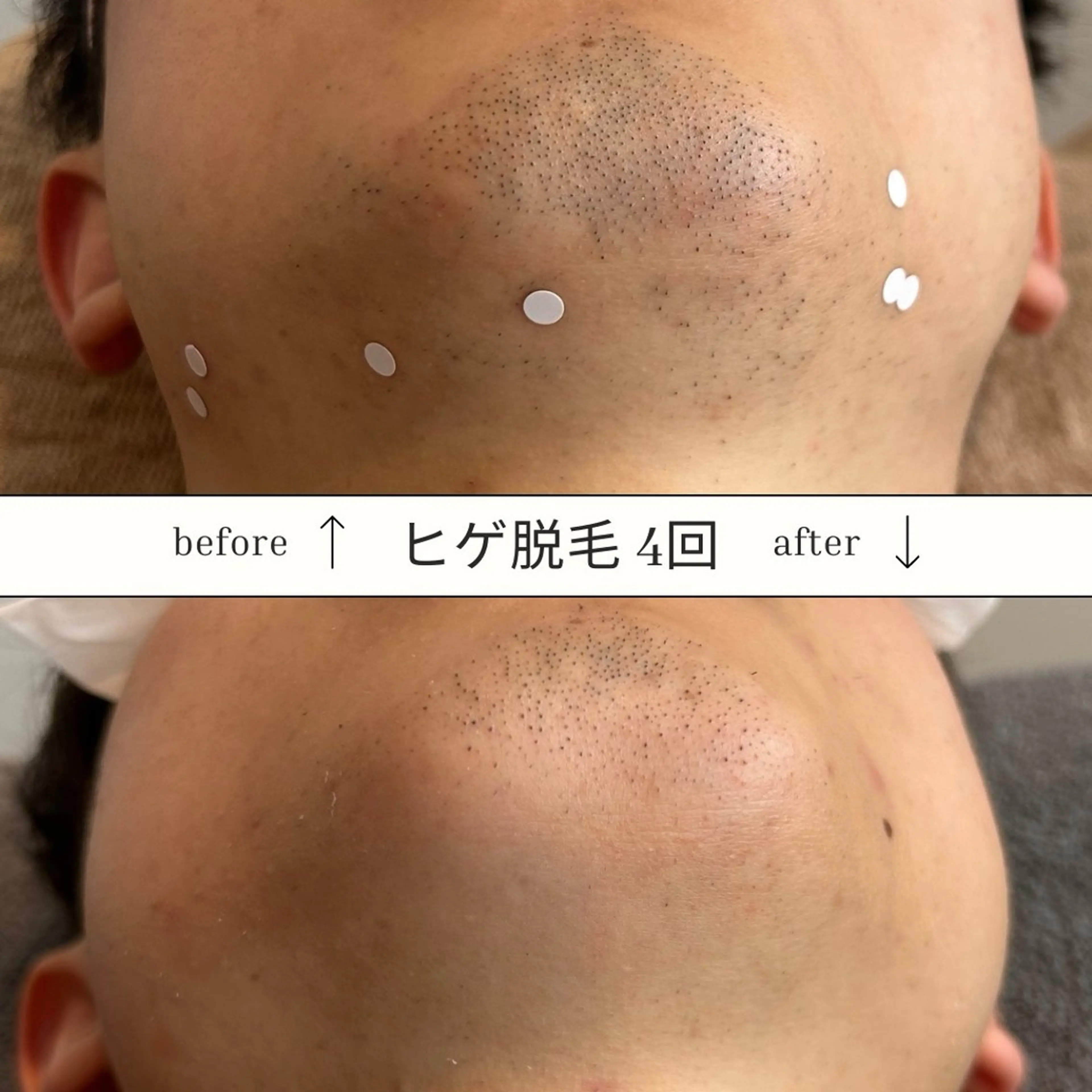 メンズ SKIN GYM メンズ専門脱毛サロンのエステ・リラクイメージ