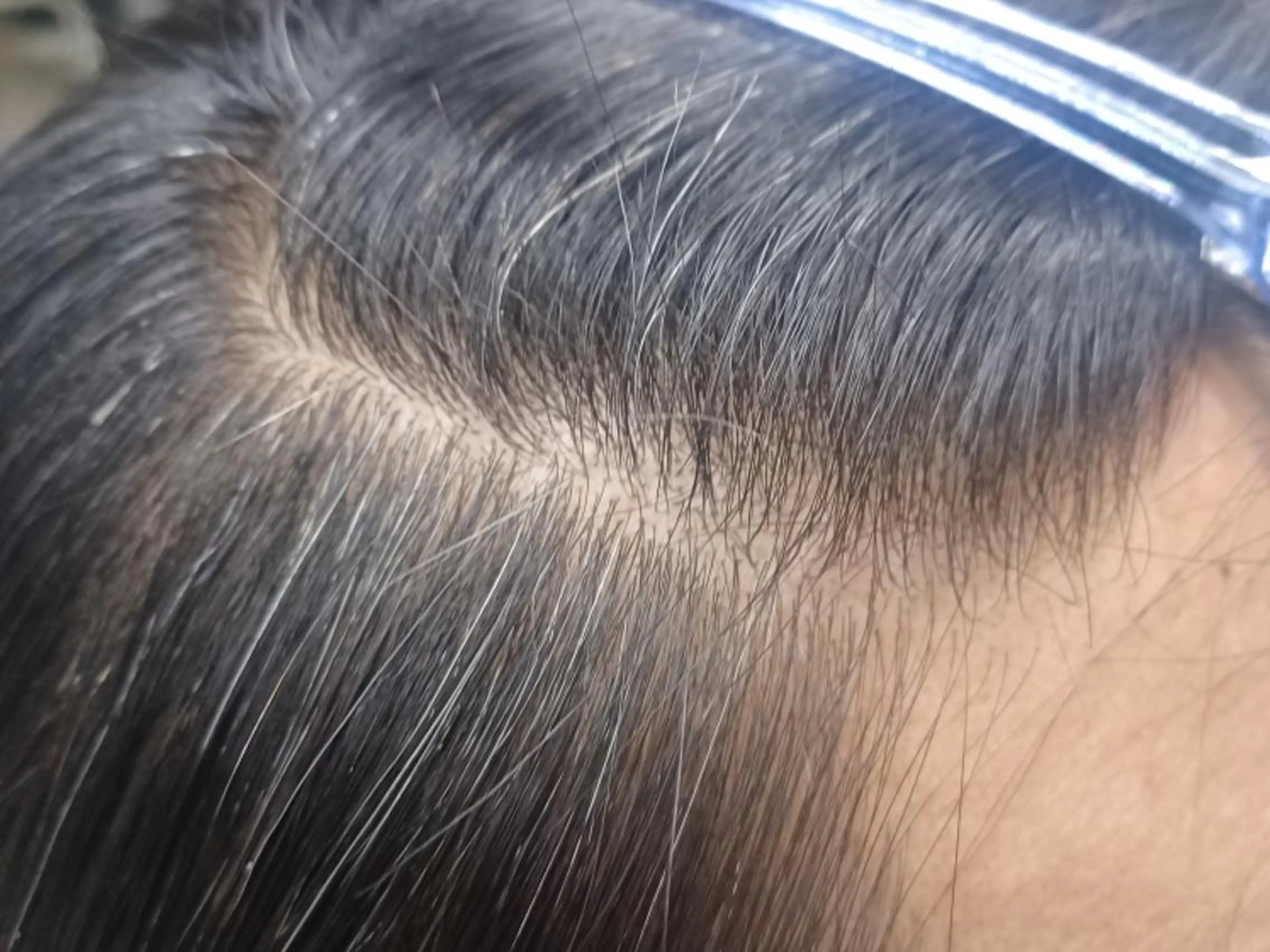 ショート カットギャラリートリイ所属・鳥居 厚志のヘアスタイル