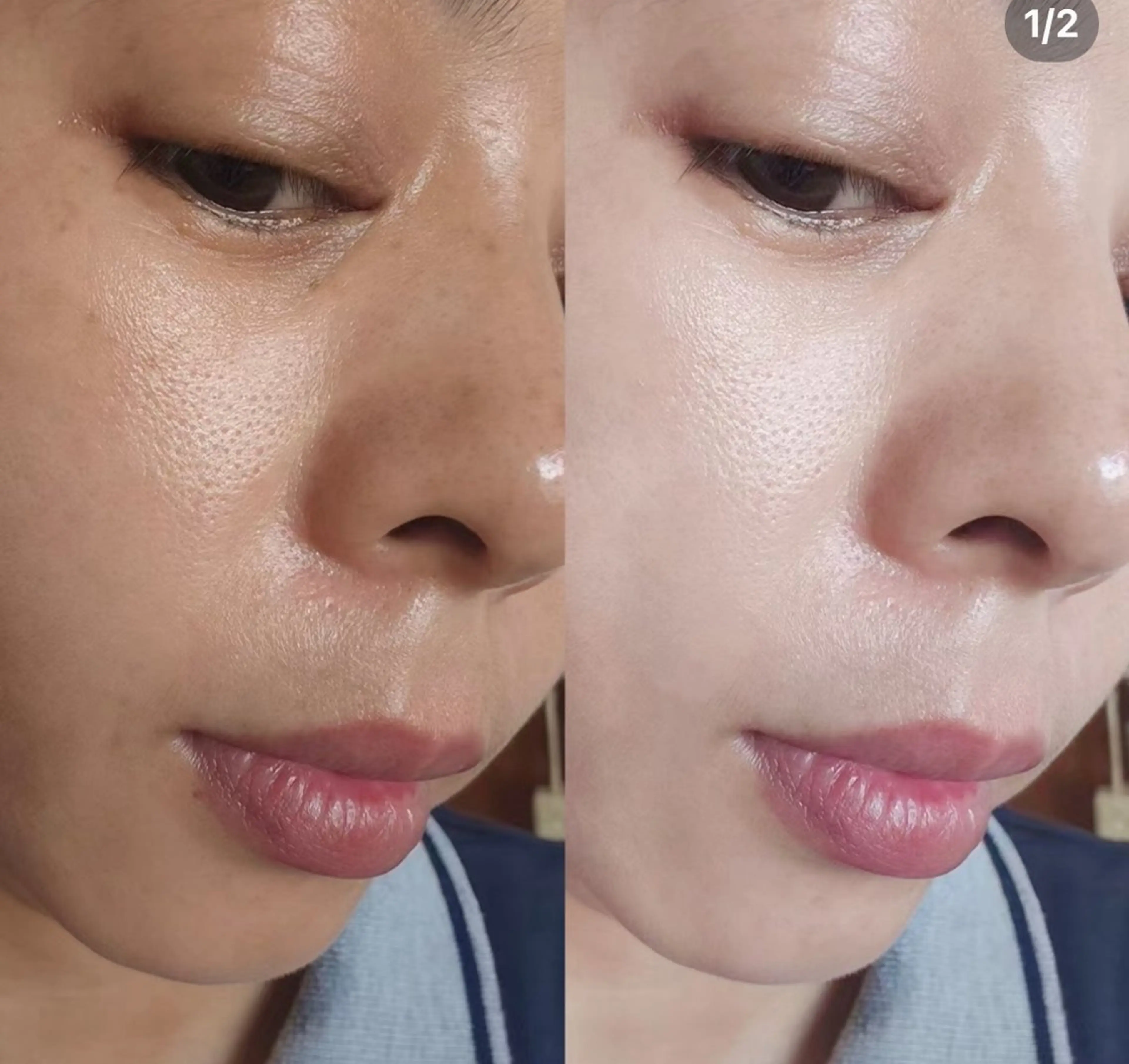 おすすめ［FACE]🦋美白＆保湿＆コラーゲンチャージ🦋✨60分¥ 3980の写真