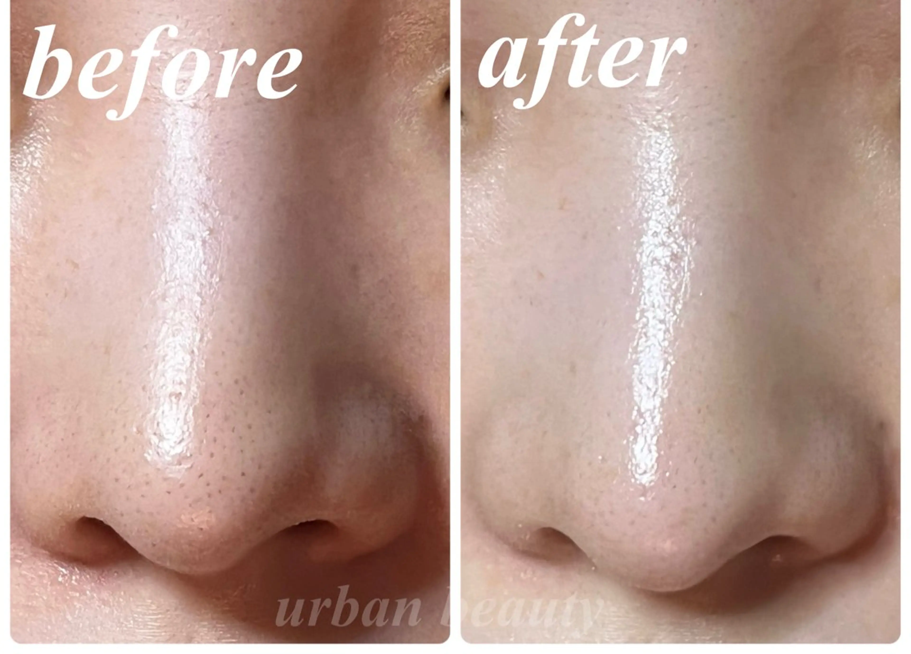 結果重視｜毛穴エステ ｜友綱理恵のエステ・リラクイメージ