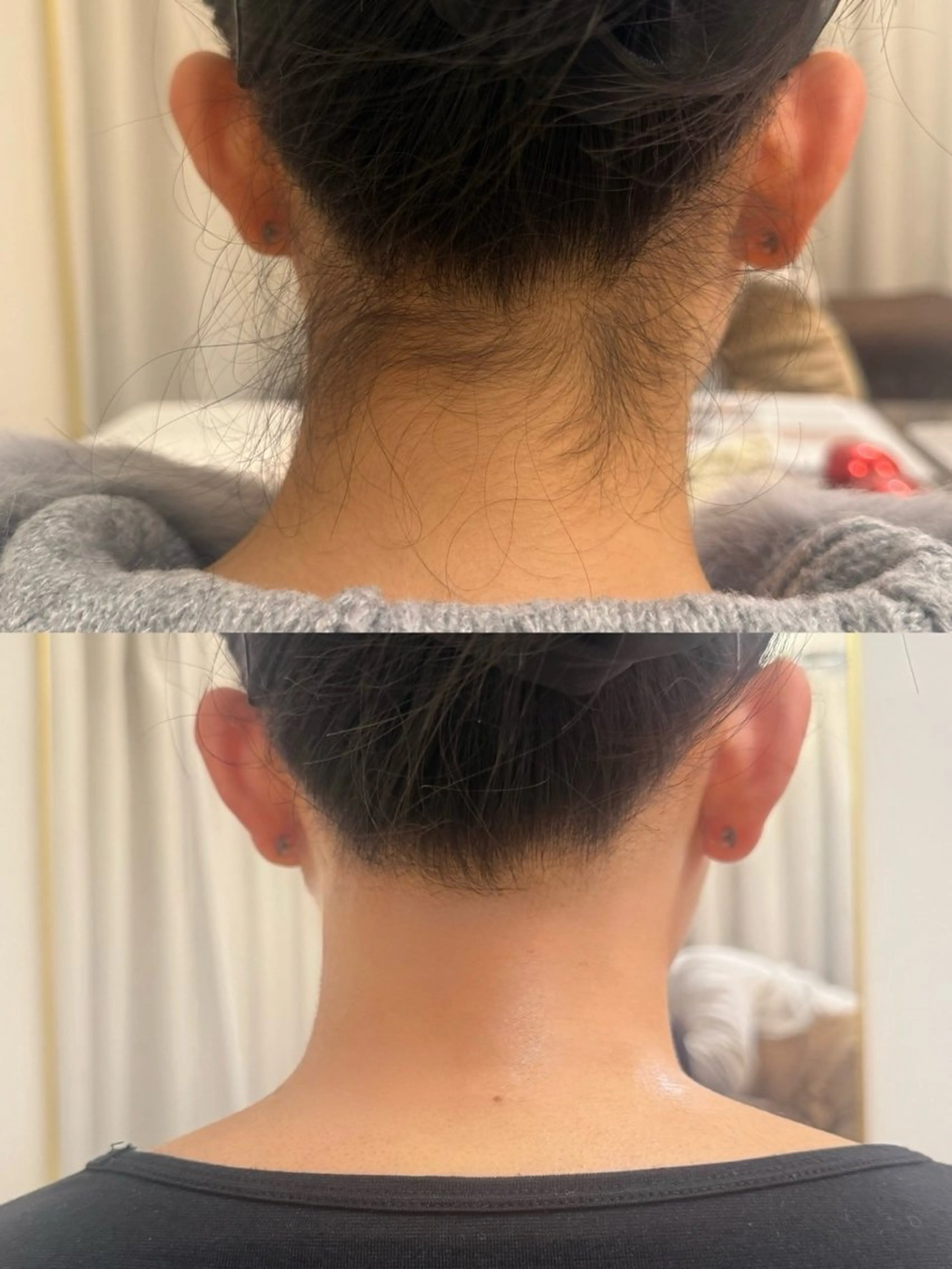 脱毛 Monart -deux-のエステ・リラクイメージ