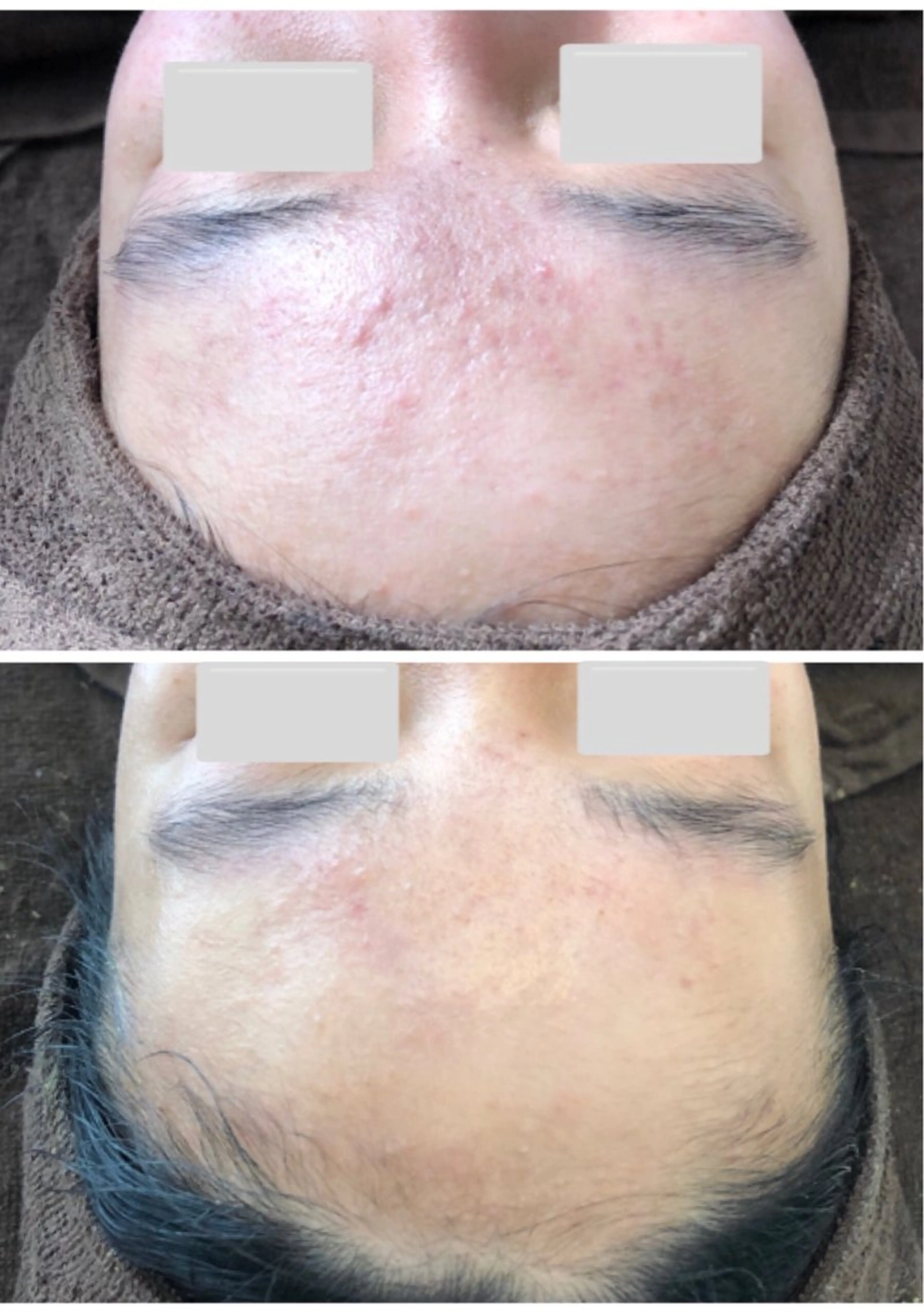 エステ 肌質改善サロン La Divinaのエステ・リラクイメージ