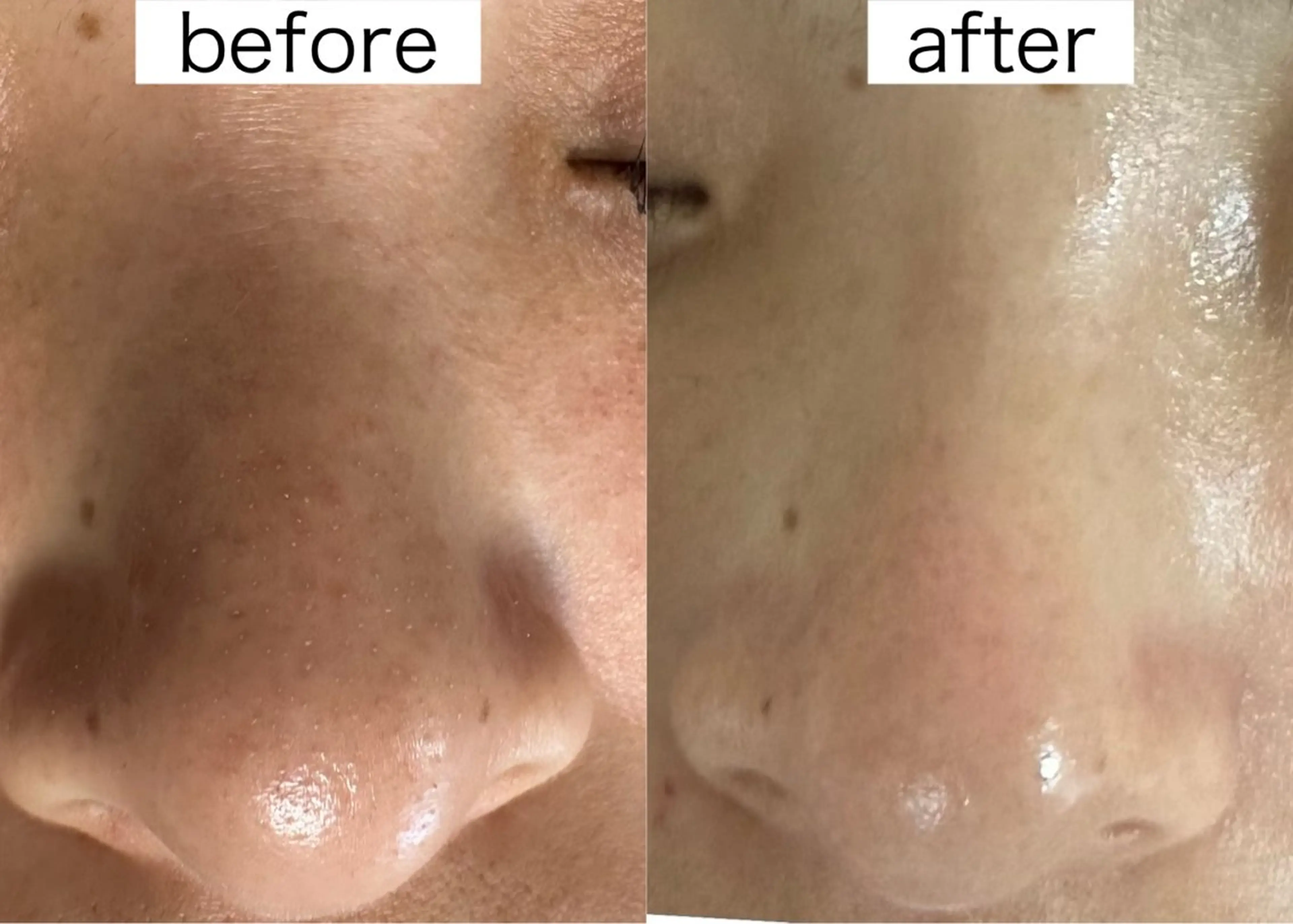 医療提携Beauty SalonMuseのエステ・リラクイメージ