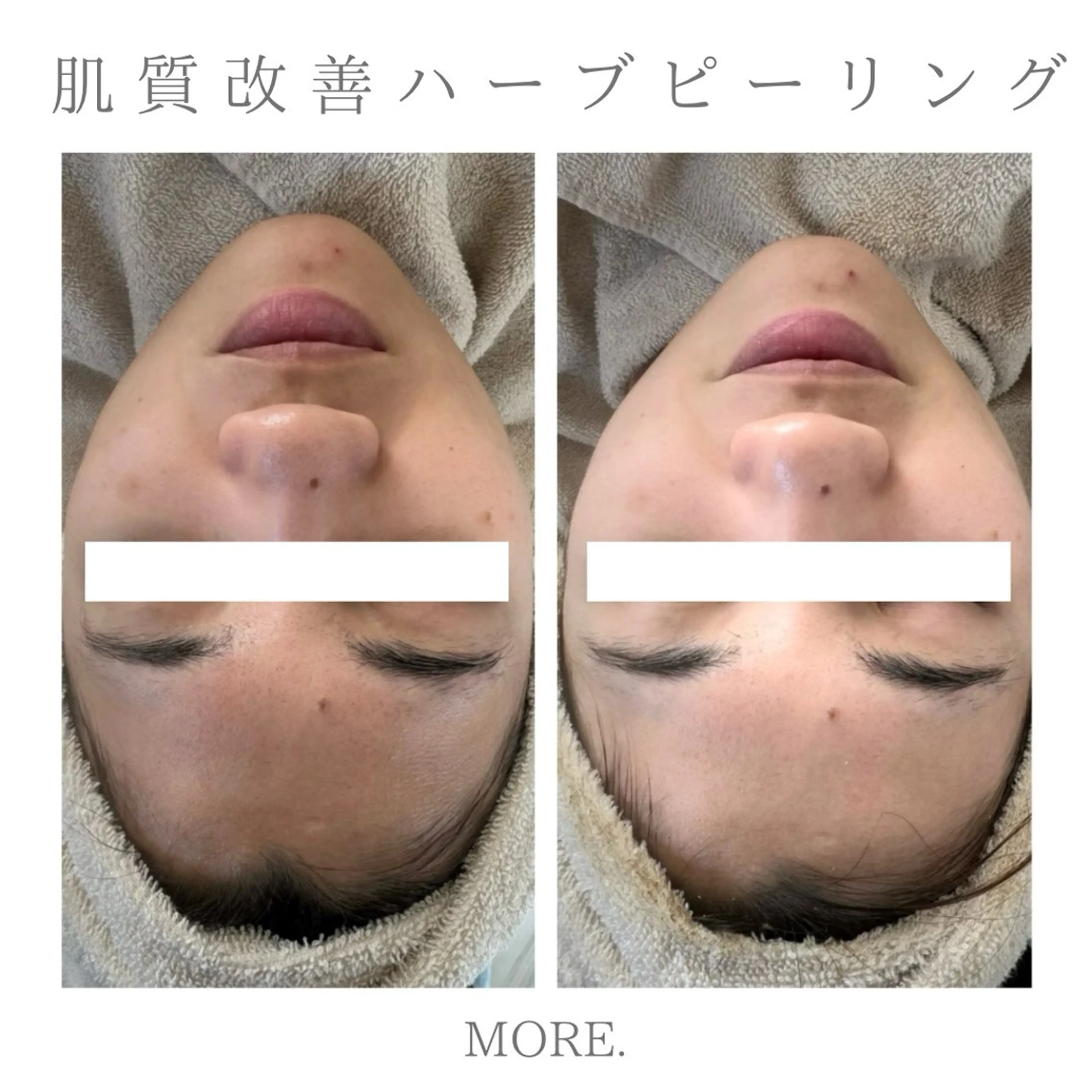 MORE. NEMAのエステ・リラクイメージ